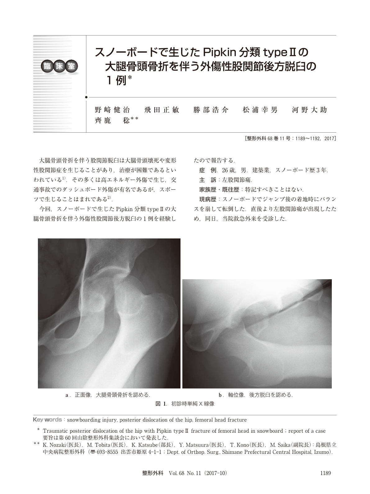 スノーボードで生じたpipkin分類type Iiの大腿骨頭骨折を伴う外傷性股関節後方脱臼の1例 臨床雑誌整形外科 68巻11号 医書 Jp