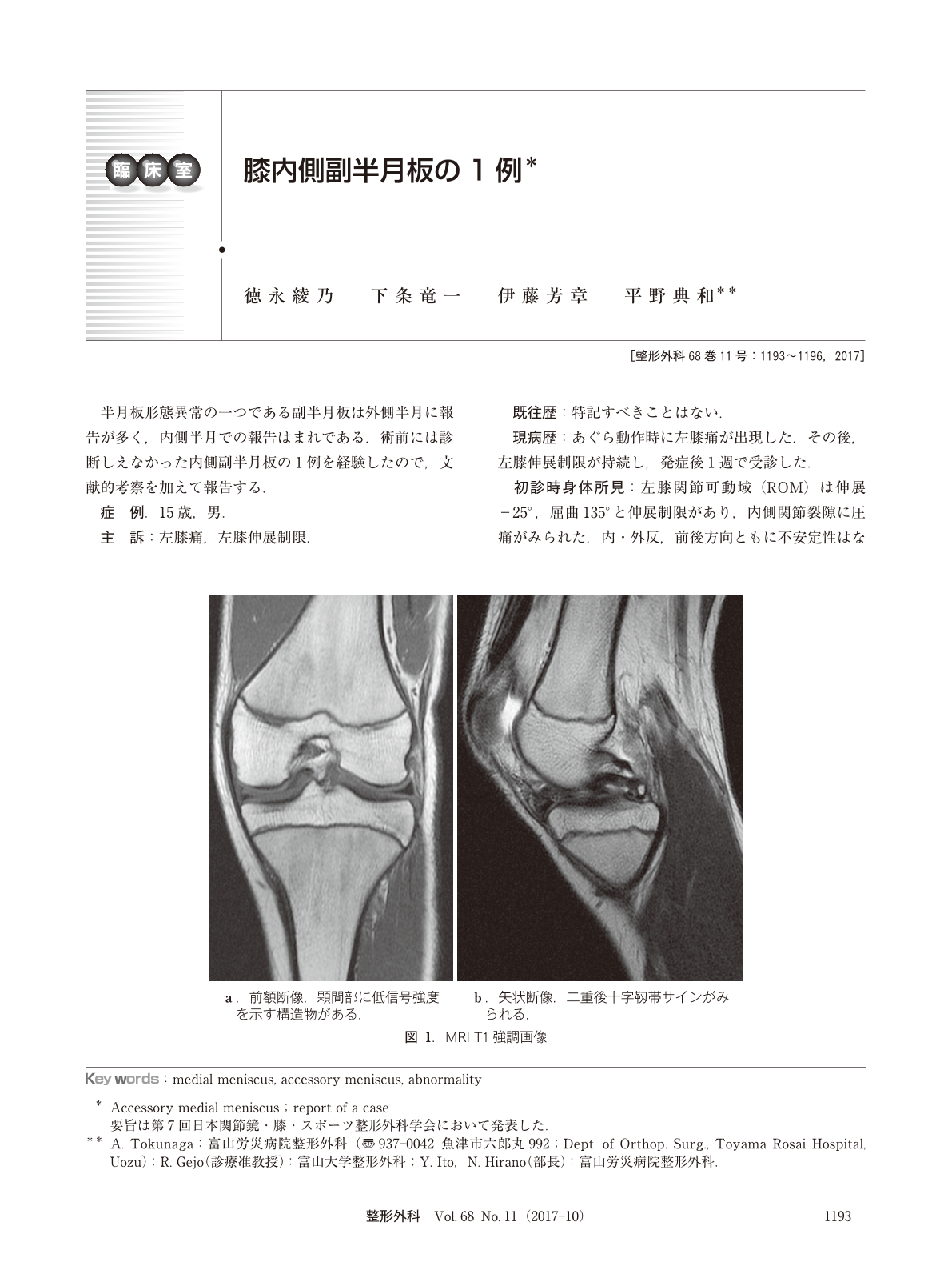 膝内側副半月板の1例 臨床雑誌整形外科 68巻11号 医書 Jp