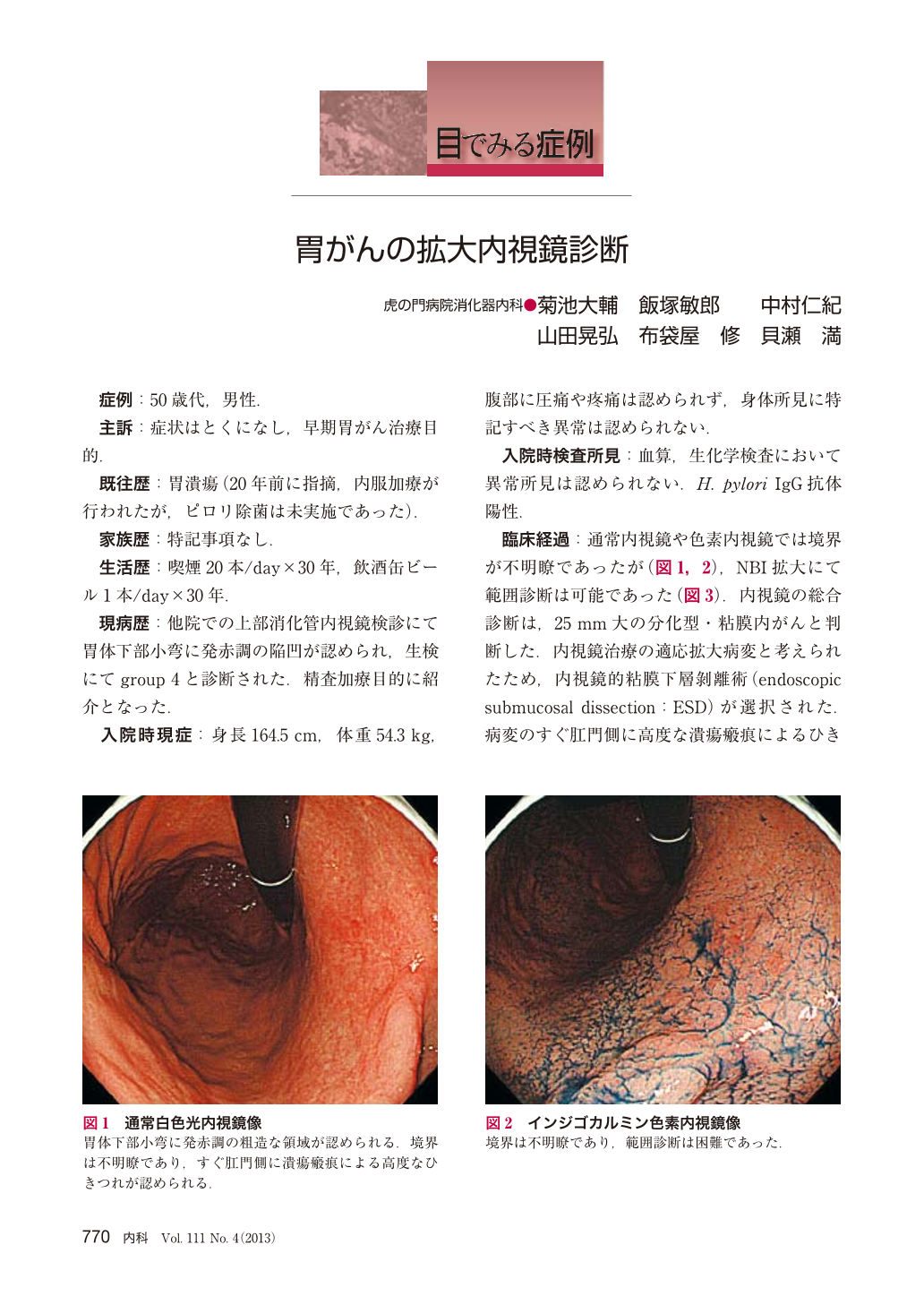 胃がんの拡大内視鏡診断 (臨床雑誌内科 111巻4号) | 医書.jp