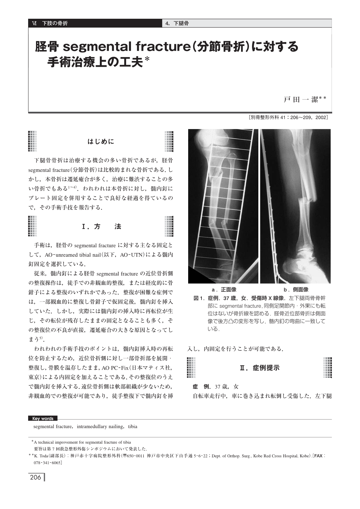 スタンダード骨折手術治療 下肢」 編集 渡部欣忍 【即発送可能