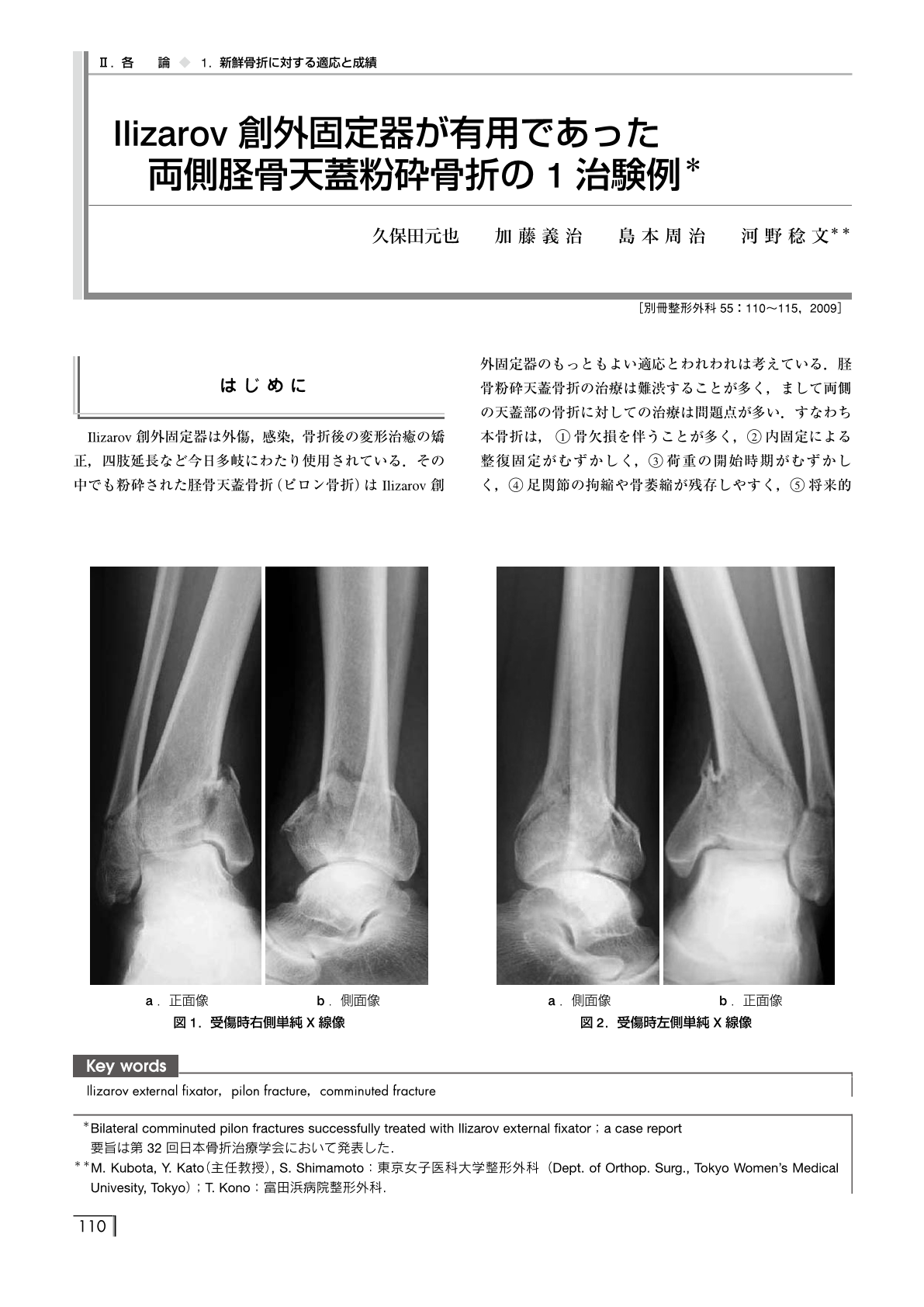 新鮮骨折に対する適応と成績 Ilizarov創外固定器が有用であった両側脛骨天蓋粉砕骨折の1治験例 別冊整形外科 1巻55号 医書 Jp