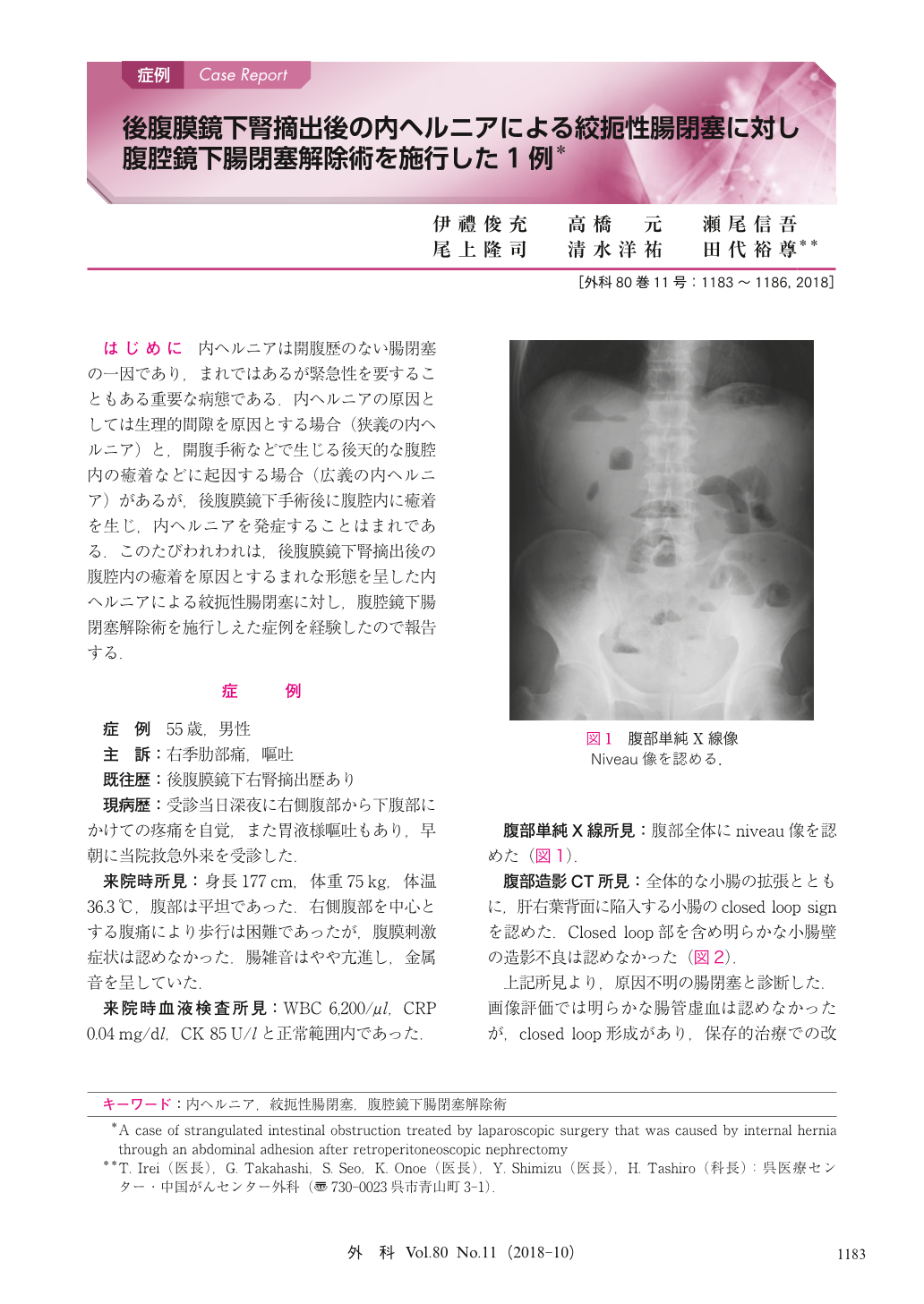 後腹膜鏡下腎摘出後の内ヘルニアによる絞扼性腸閉塞に対し腹腔鏡下