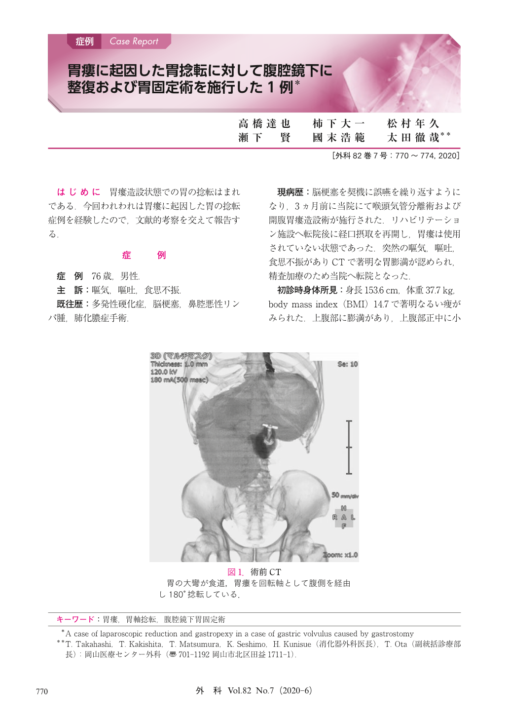胃瘻に起因した胃捻転に対して腹腔鏡下に整復および胃固定術を施行した1例 臨床雑誌外科 巻7号 医書 Jp