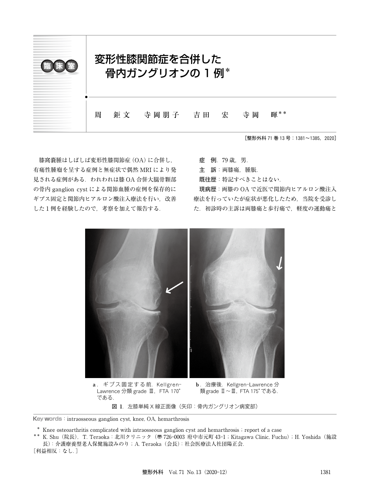 変形性膝関節症を合併した骨内ガングリオンの1例 臨床雑誌整形外科 71巻13号 医書 Jp