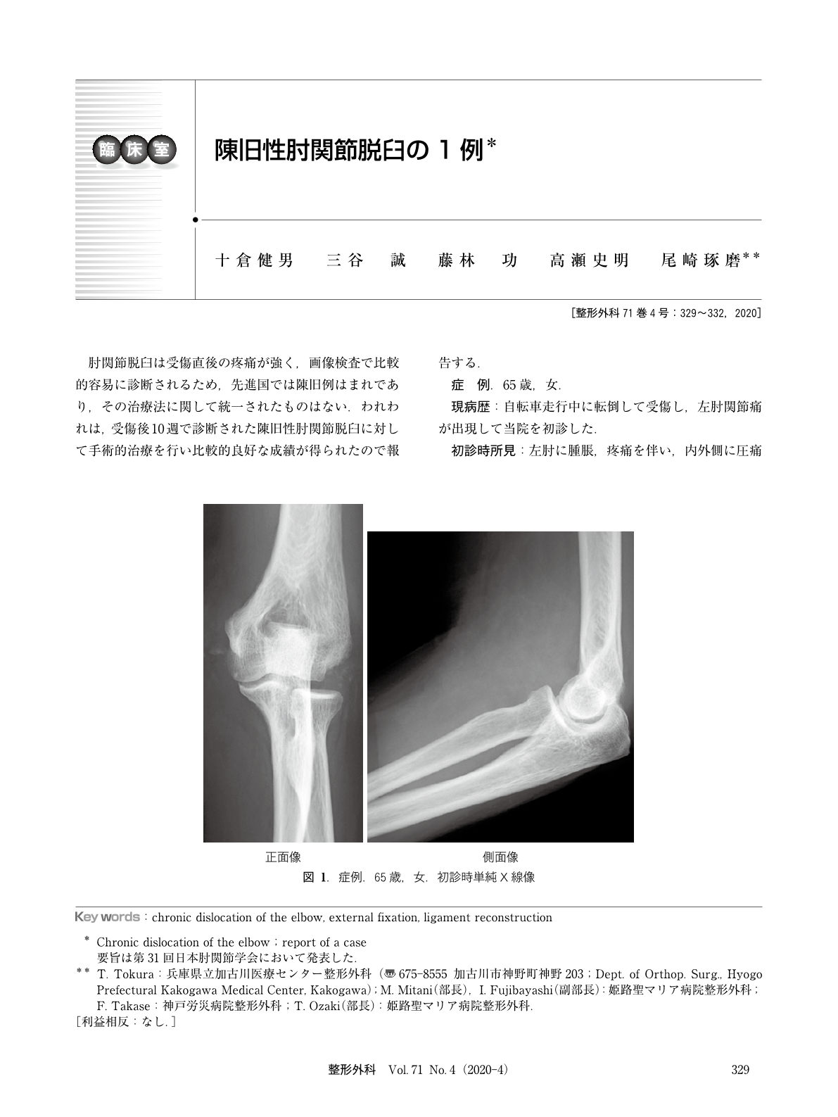 陳旧性肘関節脱臼の1例 臨床雑誌整形外科 71巻4号 医書 Jp