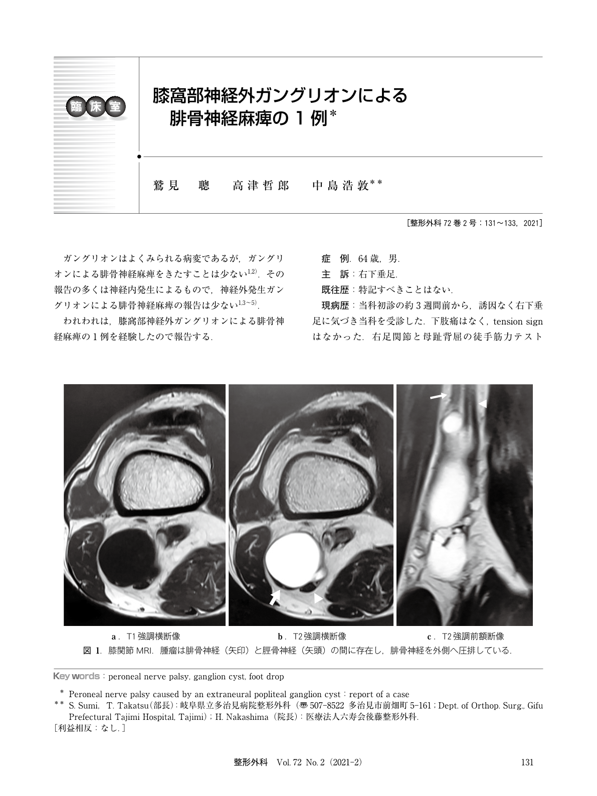 膝窩部神経外ガングリオンによる腓骨神経麻痺の1例 臨床雑誌整形外科 72巻2号 医書 Jp