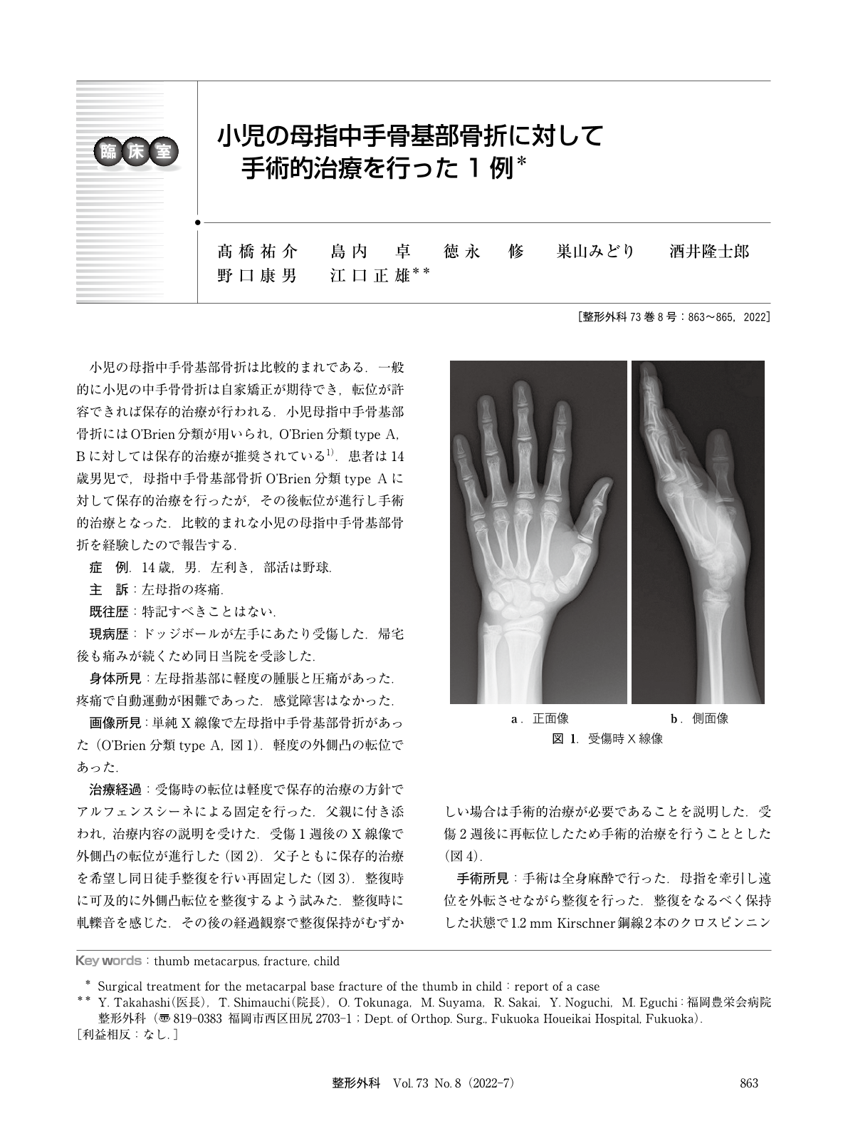小児の母指中手骨基部骨折に対して手術的治療を行った1例 臨床雑誌