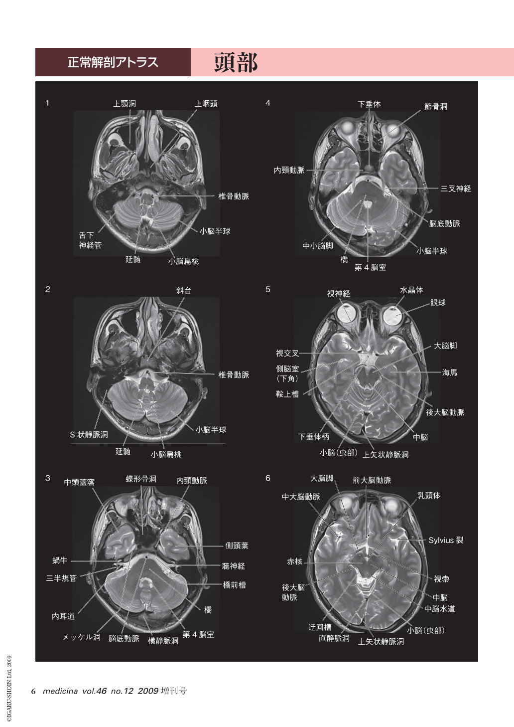 送料無料・選べる4個セット 脳MRI 1(正常解剖) - 通販 - www.smschool 