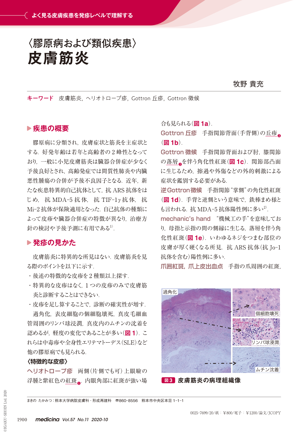 皮膚筋炎 (medicina 57巻11号) | 医書.jp