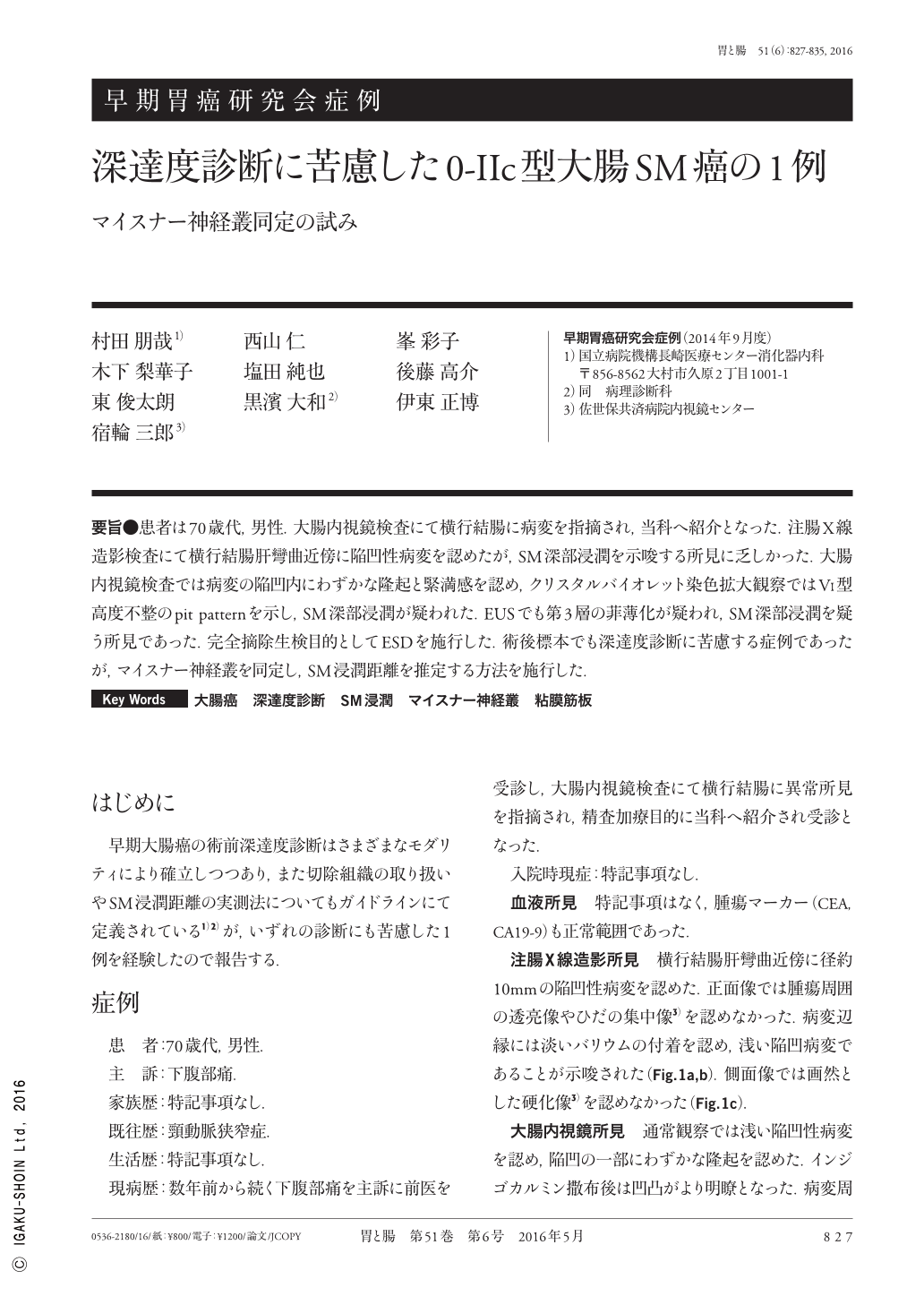 深達度診断に苦慮した0 Iic型大腸sm癌の1例 マイスナー神経叢同定の試み 胃と腸 51巻6号 医書 Jp