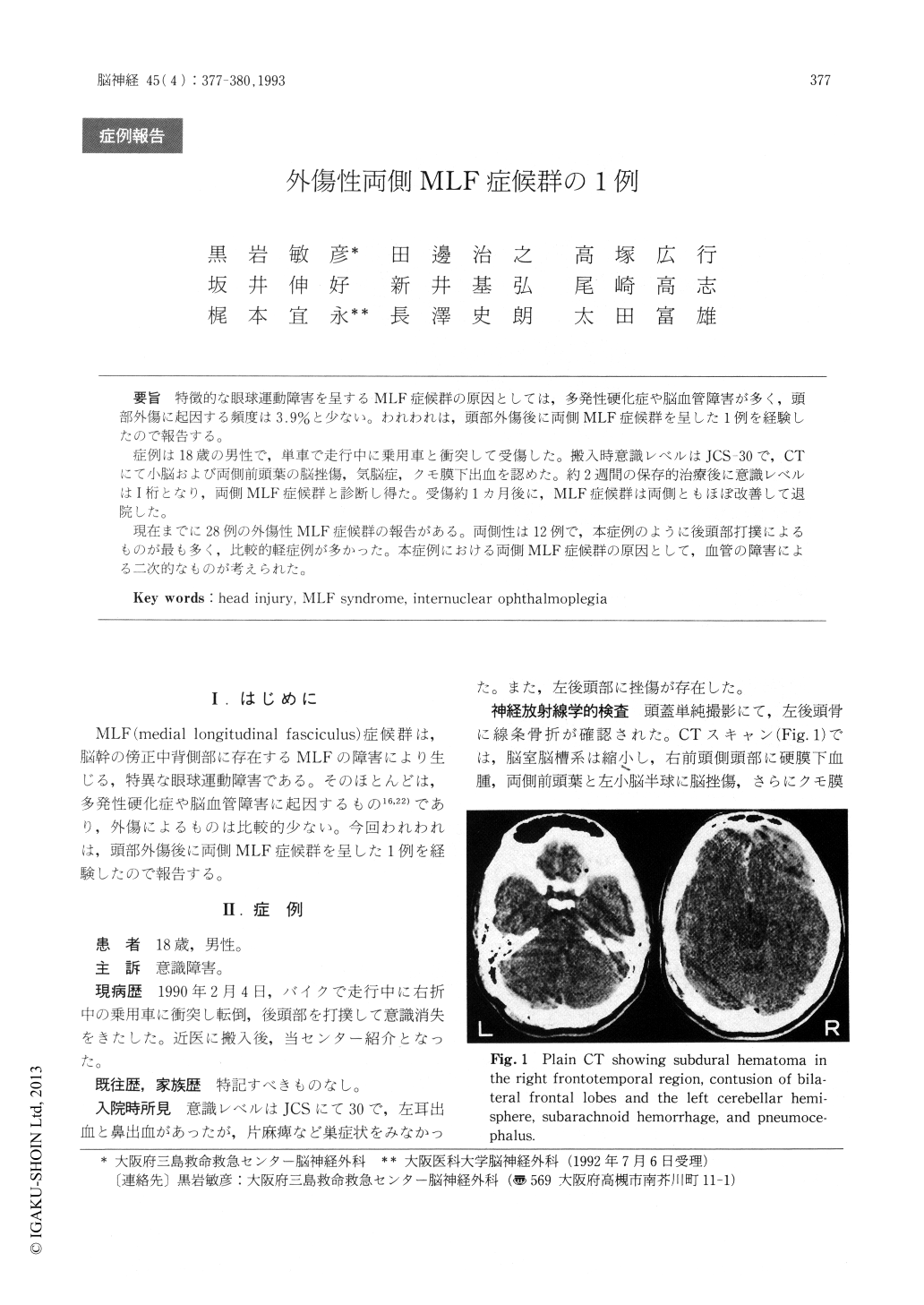 外傷性両側mlf症候群の1例 Brain And Nerve 脳と神経 45巻4号 医書 Jp