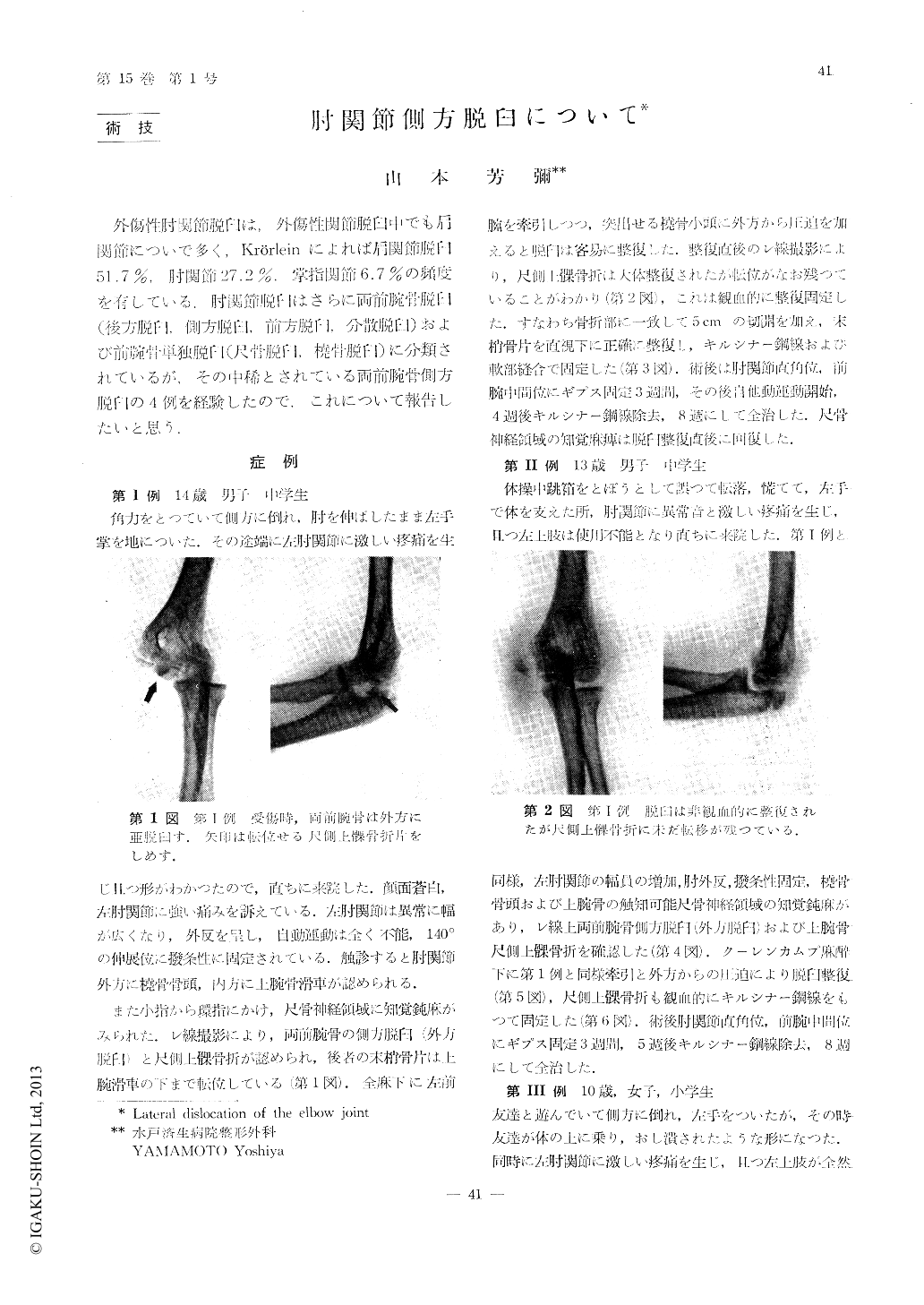 肘関節側方脱臼について 臨床外科 15巻1号 医書 Jp