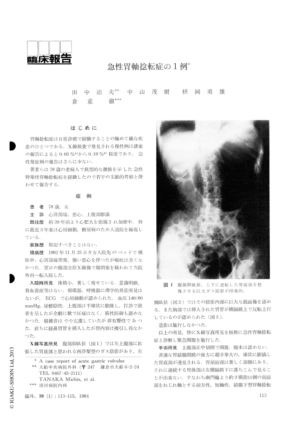 急性胃軸捻転症の1例 臨床外科 39巻1号 医書 Jp