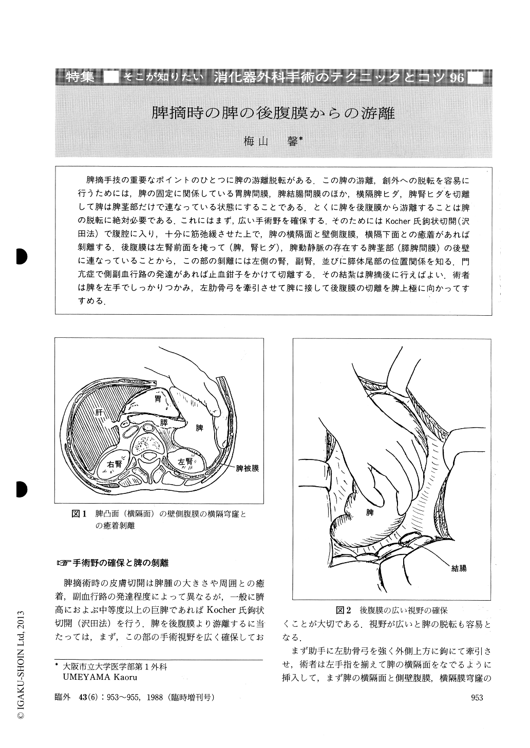 脾摘時の脾の後腹膜からの游離 (臨床外科 43巻6号) | 医書.jp