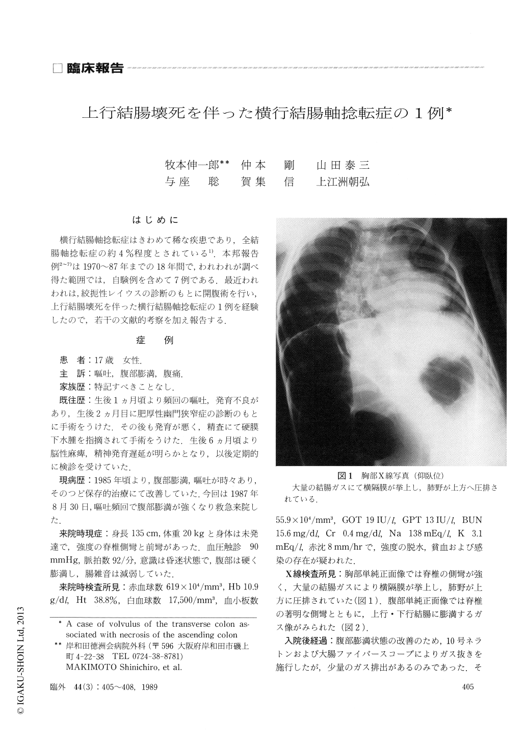 上行結腸壊死を伴った横行結腸軸捻転症の1例 臨床外科 44巻3号 医書 Jp