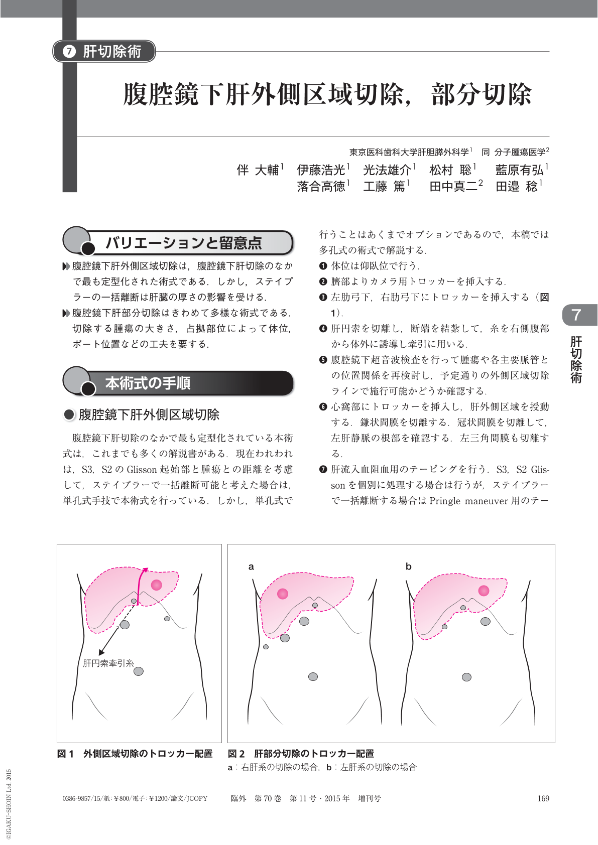 腹腔鏡下肝外側区域切除，部分切除 (臨床外科 70巻11号) | 医書.jp