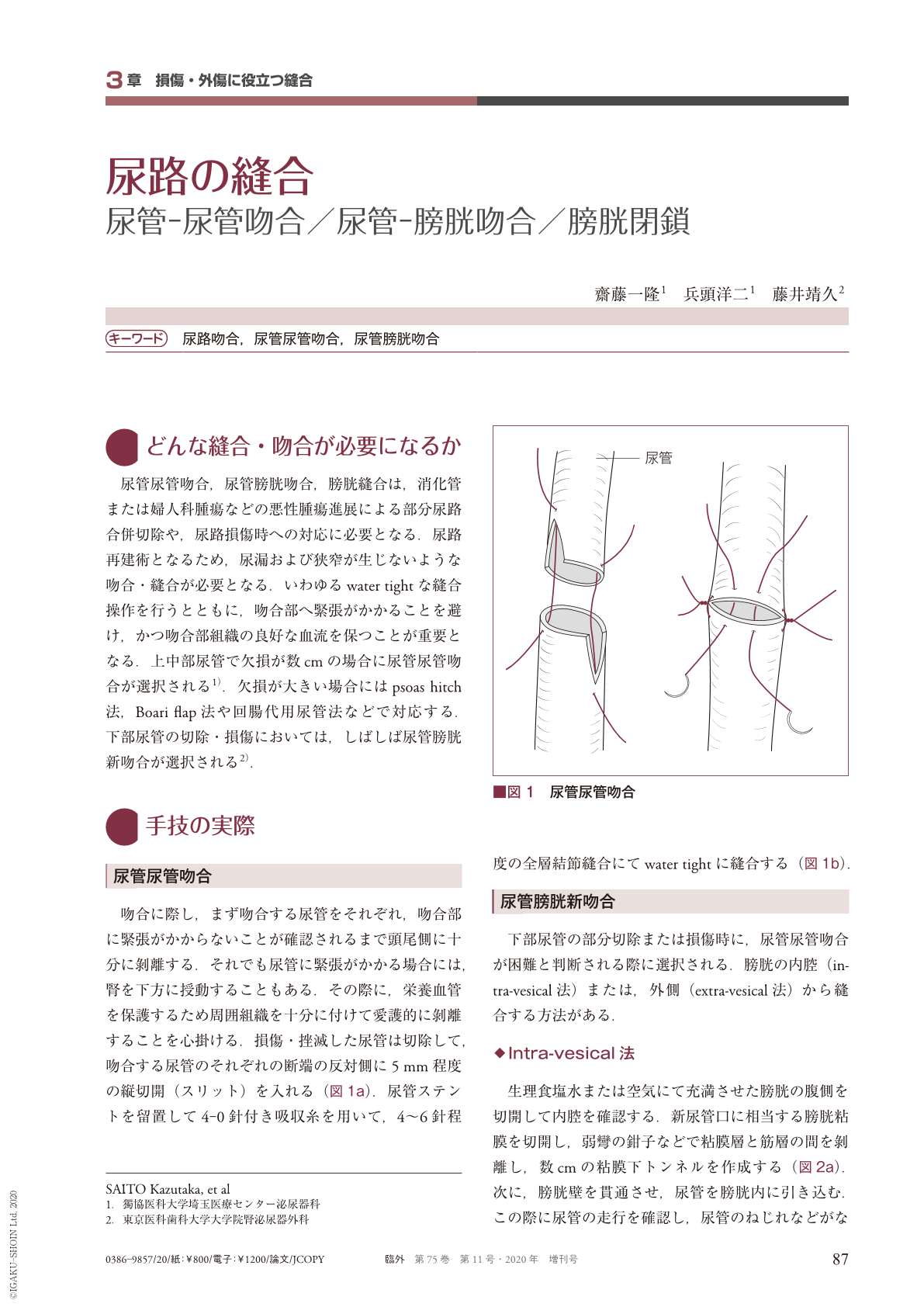 尿路の縫合—尿管-尿管吻合／尿管-膀胱吻合／膀胱閉鎖 (臨床外科 75巻11 