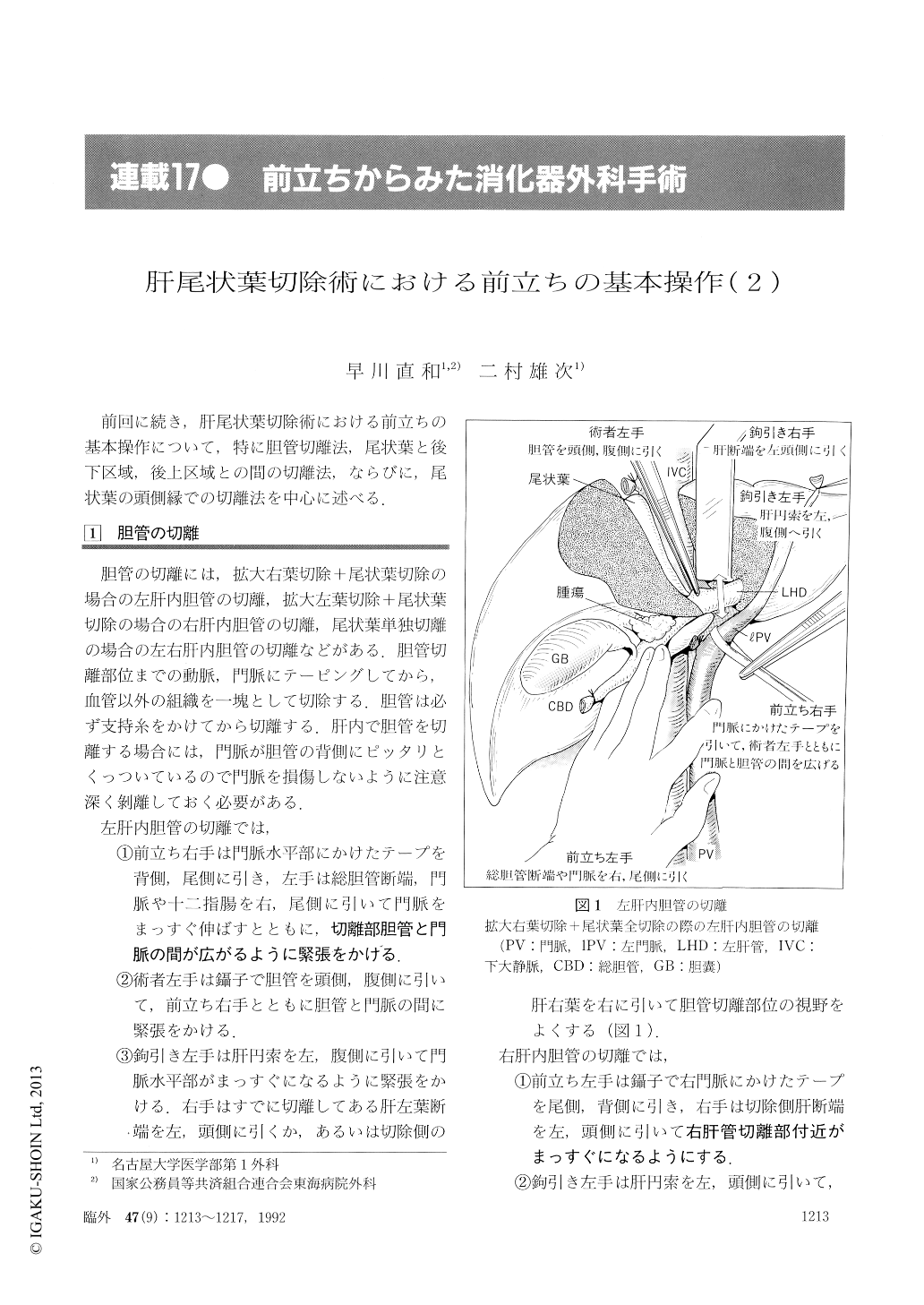 肝尾状葉切除術における前立ちの基本操作 2 臨床外科 47巻9号 医書 Jp