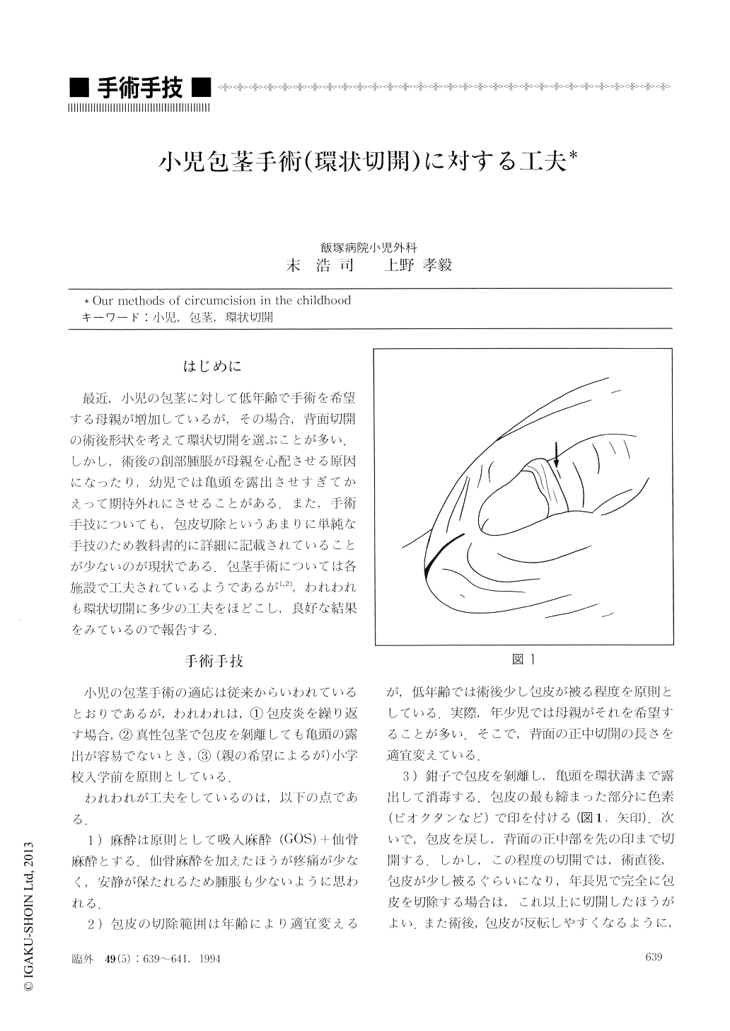 小児包茎手術 環状切開 に対する工夫 臨床外科 49巻5号 医書 Jp