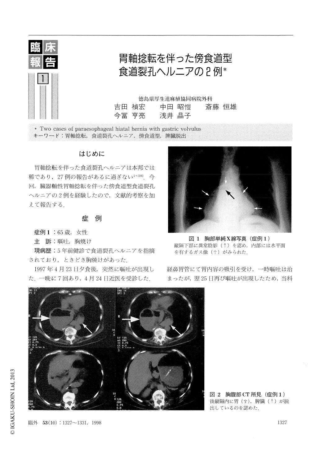 胃軸捻転を伴った傍食道型食道裂孔ヘルニアの2例 臨床外科 53巻10号 医書 Jp
