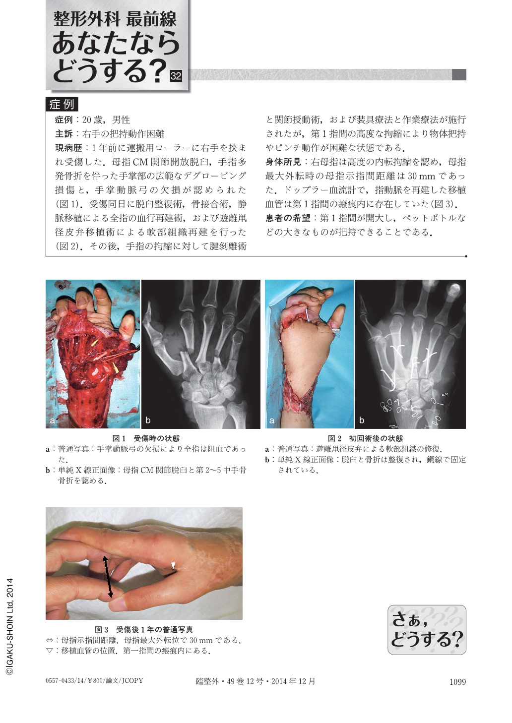 整形外科最前線 あなたならどうする？ (臨床整形外科 49巻12号) | 医書.jp