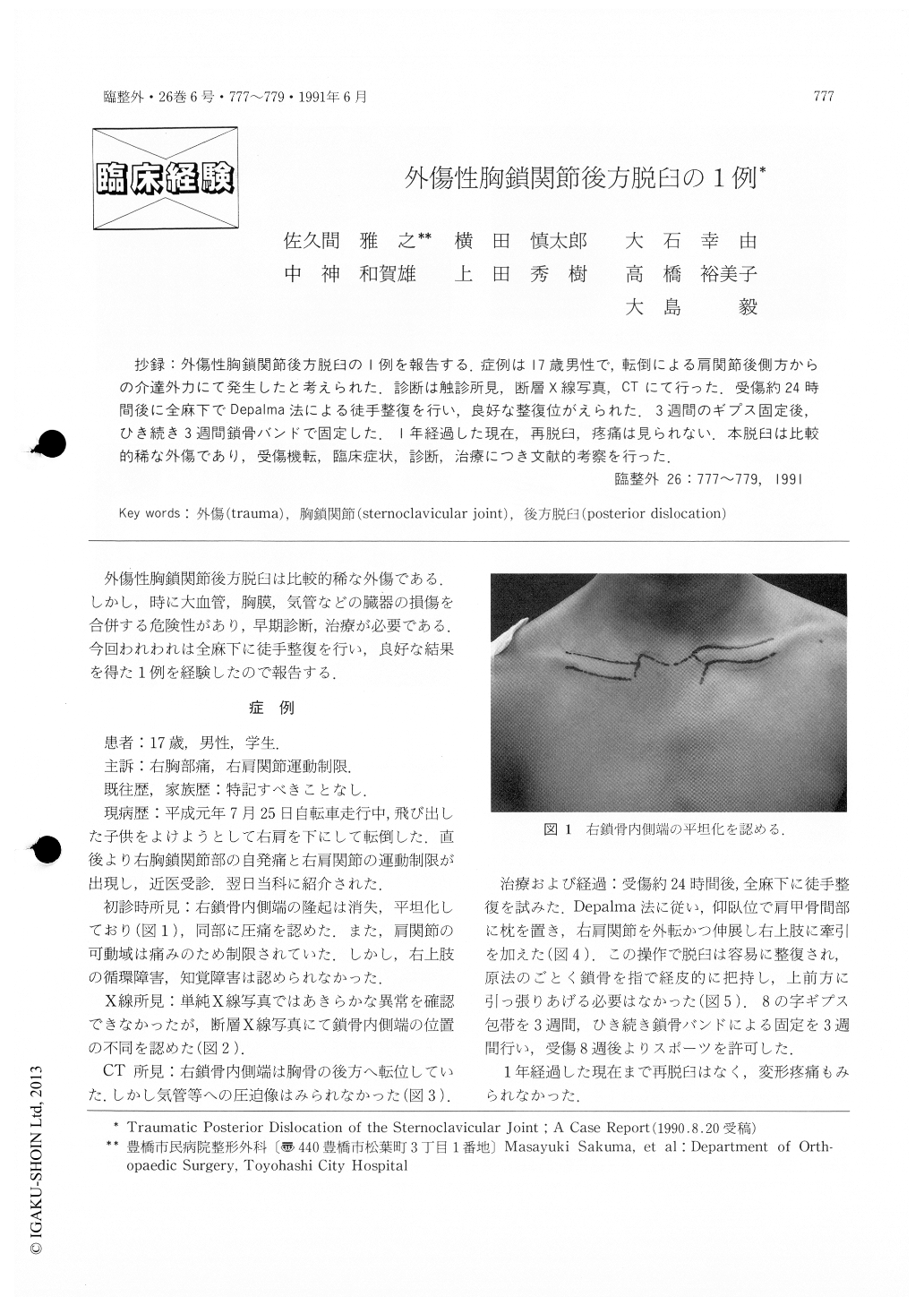 外傷性胸鎖関節後方脱臼の1例 臨床整形外科 26巻6号 医書 Jp
