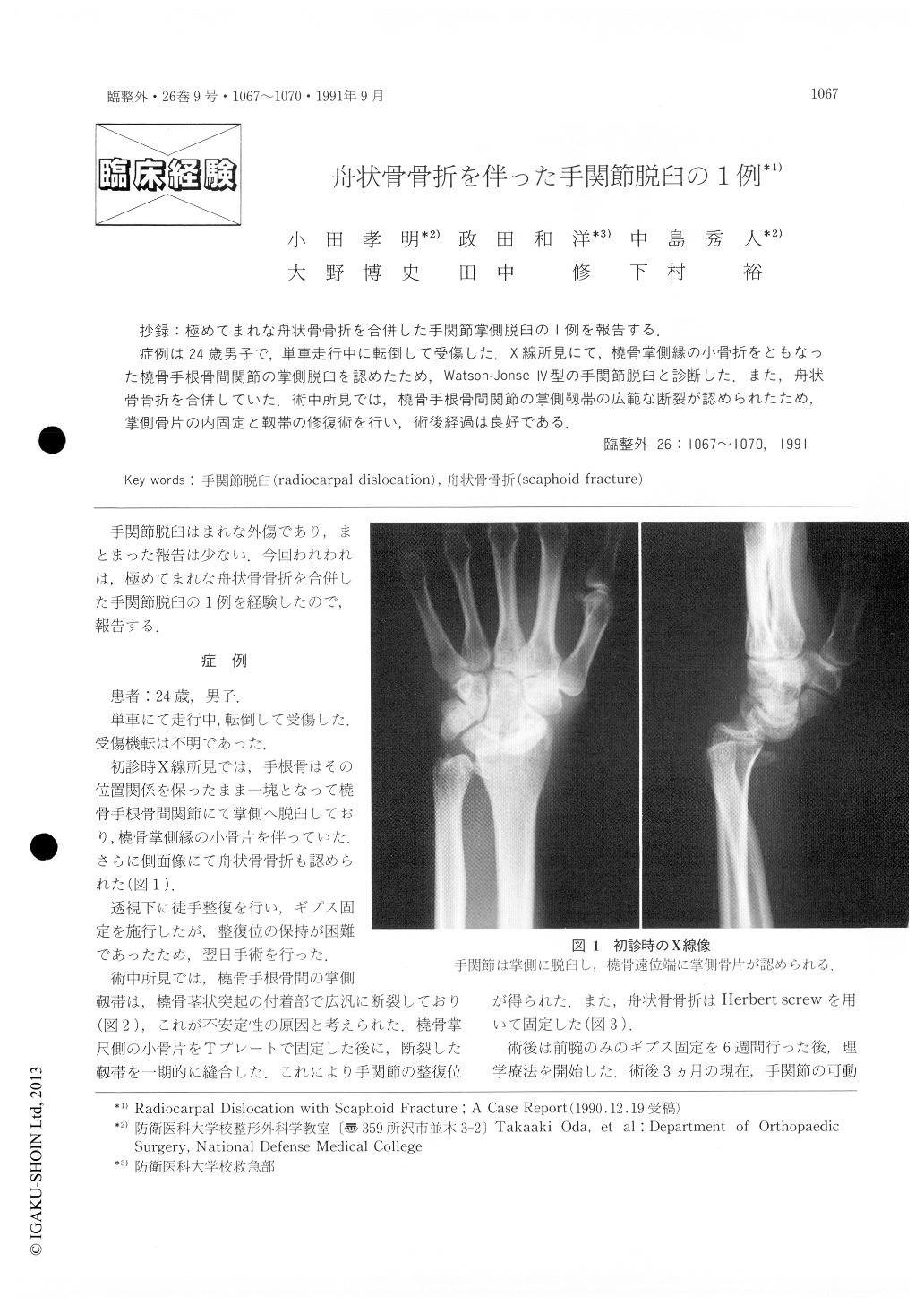 舟状骨骨折を伴った手関節脱臼の1例 (臨床整形外科 26巻9号) | 医書.jp