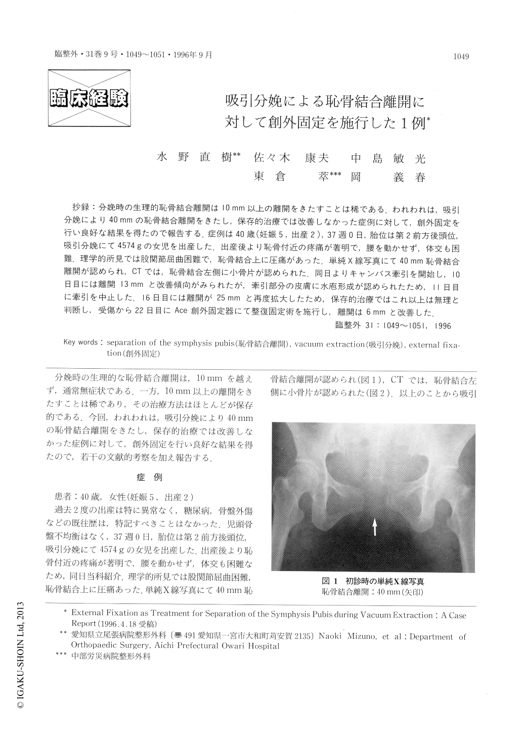 吸引分娩による恥骨結合離開に対して創外固定を施行した1例 臨床整形外科 31巻9号 医書 Jp