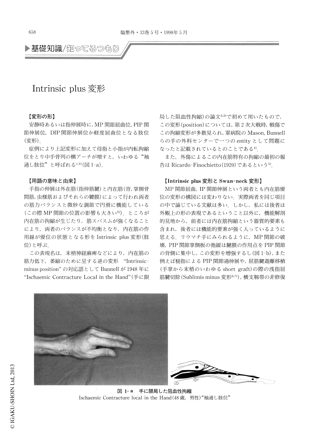 Intrinsic Plus変形 臨床整形外科 33巻5号 医書 Jp