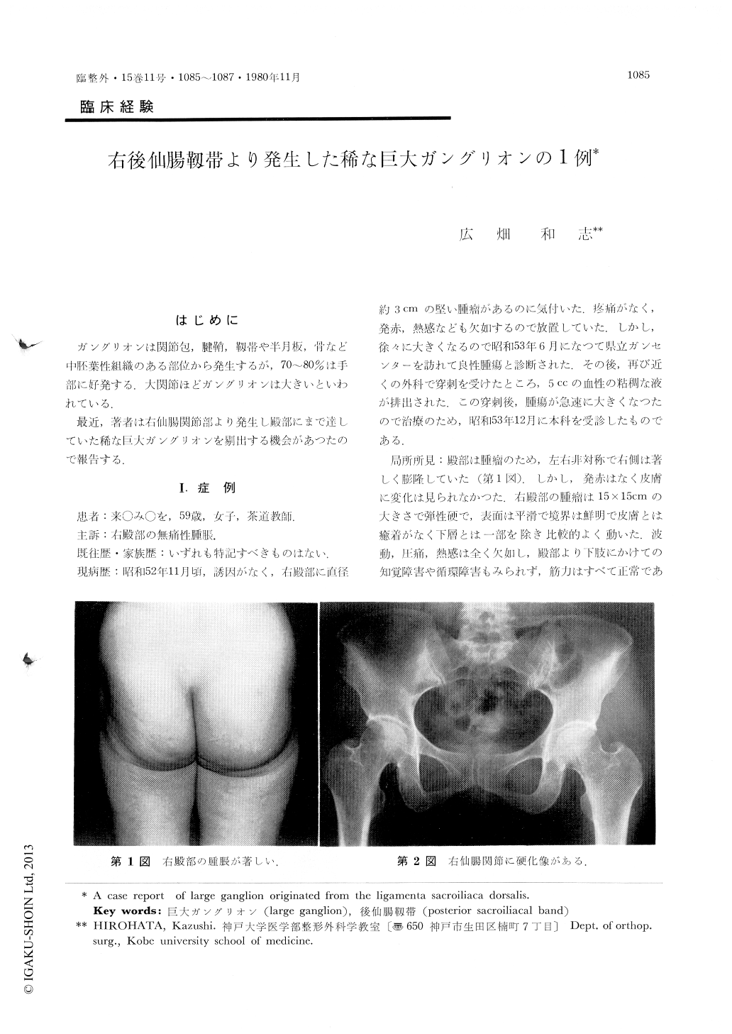 右後仙腸靱帯より発生した稀な巨大ガングリオンの1例 臨床整形外科 15巻11号 医書 Jp