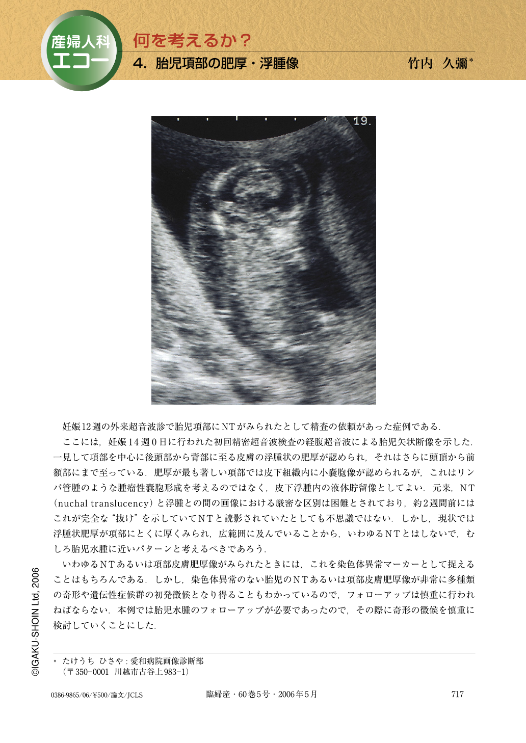 胎児項部の肥厚 浮腫像 臨床婦人科産科 60巻5号 医書 Jp