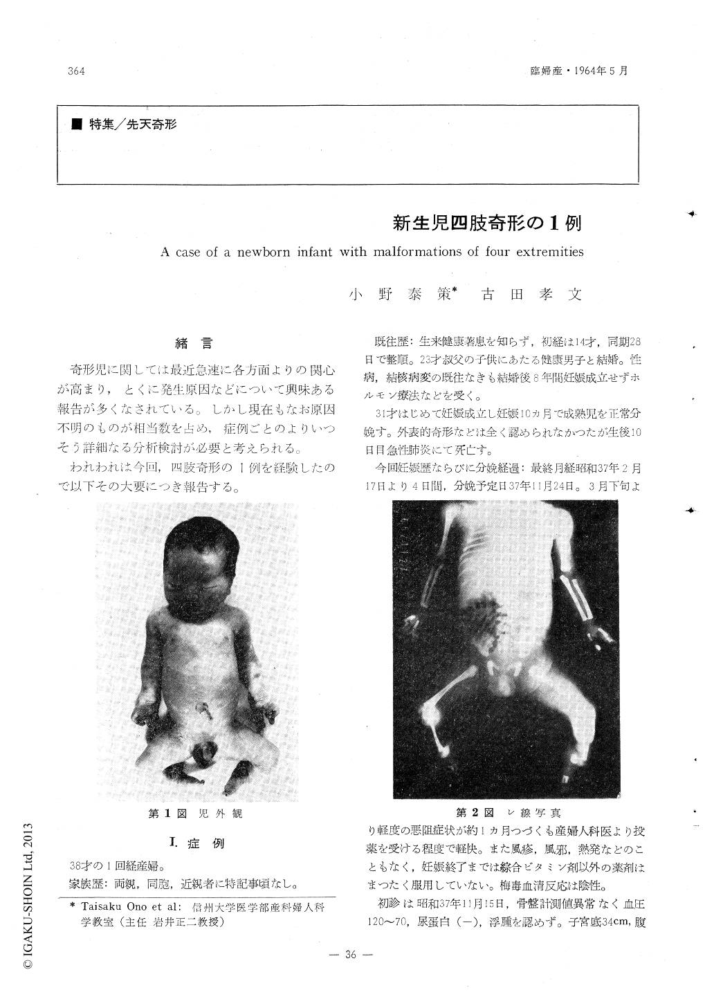 新生児四肢奇形の1例 臨床婦人科産科 18巻5号 医書 Jp