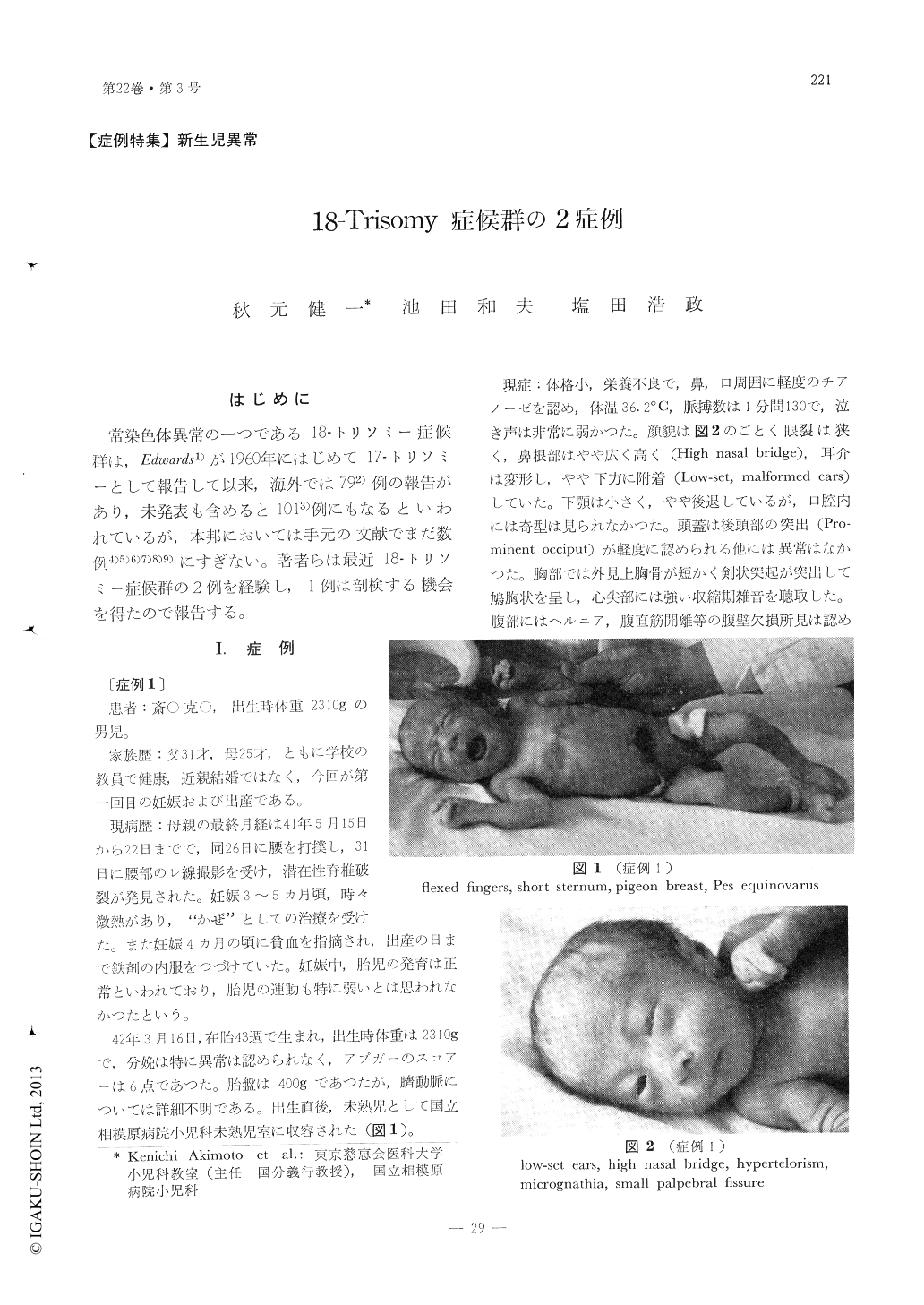 18-Trisomy症候群の2症例 (臨床婦人科産科 22巻3号) | 医書.jp