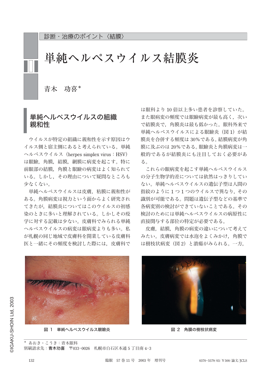 単純ヘルペスウイルス結膜炎 (臨床眼科 57巻11号) | 医書.jp