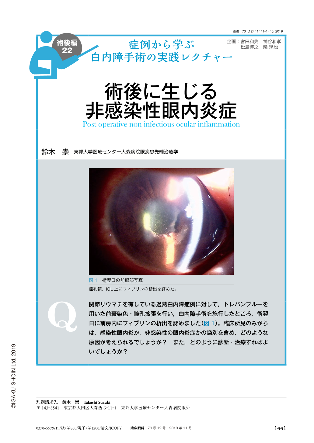 術後に生じる非感染性眼内炎症 (臨床眼科 73巻12号) | 医書.jp