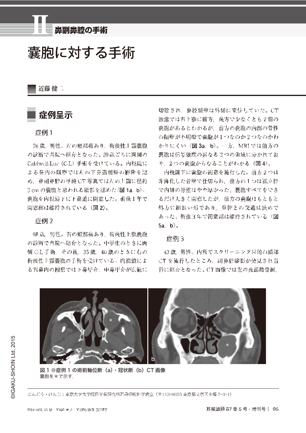 囊胞に対する手術 (耳鼻咽喉科・頭頸部外科 87巻5号) | 医書.jp