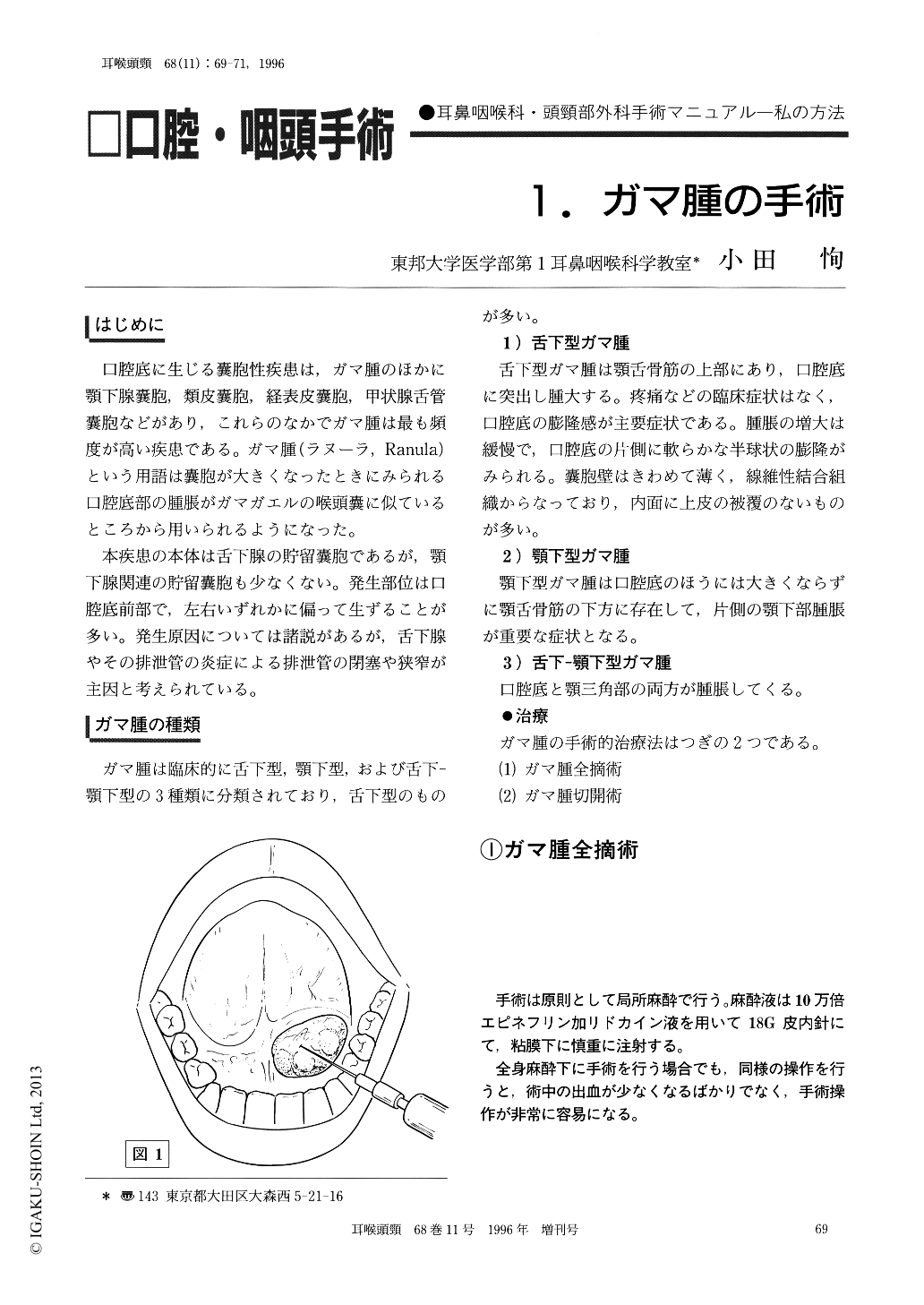 1．ガマ腫の手術 (耳鼻咽喉科・頭頸部外科 68巻11号) | 医書.jp
