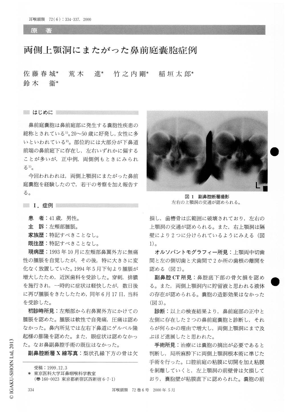 両側上顎洞にまたがった鼻前庭嚢胞症例 耳鼻咽喉科 頭頸部外科 72巻6号 医書 Jp