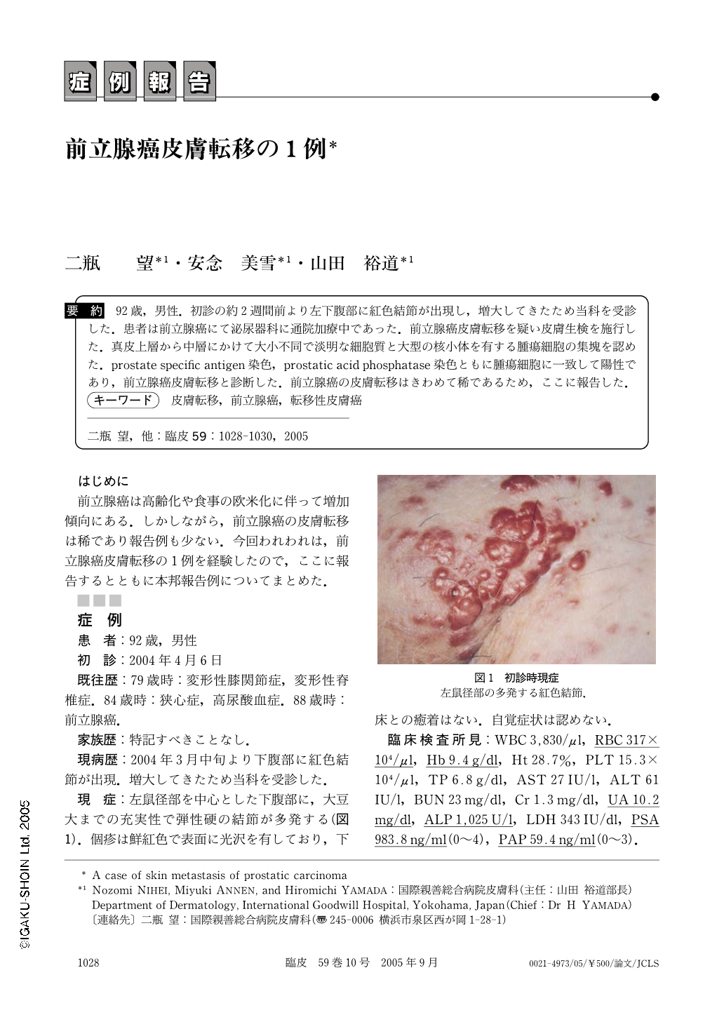 前立腺癌皮膚転移の1例 臨床皮膚科 59巻10号 医書 Jp