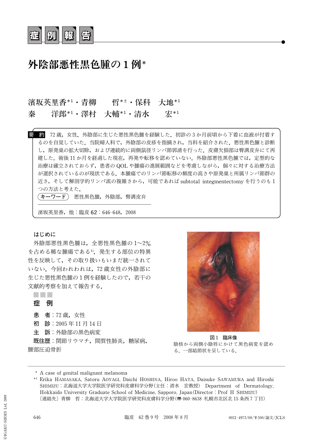 外陰部悪性黒色腫の1例 臨床皮膚科 62巻9号 医書 Jp
