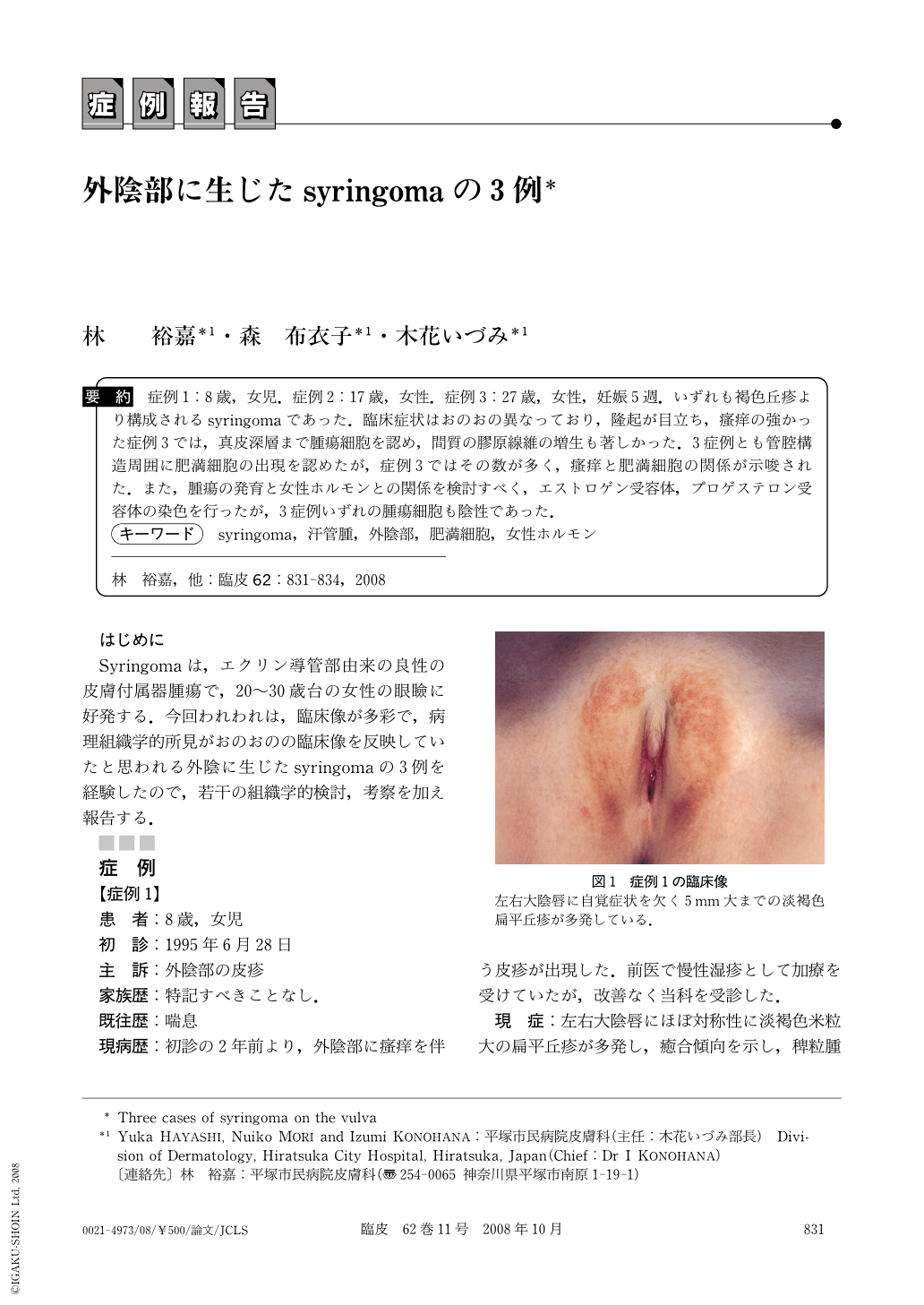 外陰部に生じたsyringomaの3例 臨床皮膚科 62巻11号 医書 Jp