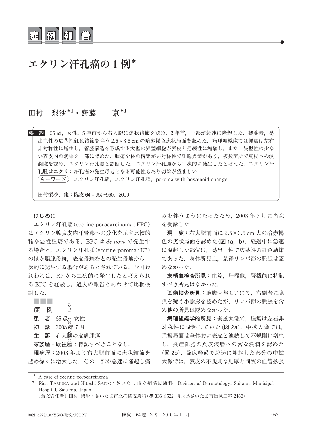 エクリン汗孔癌の1例 臨床皮膚科 64巻12号 医書 Jp