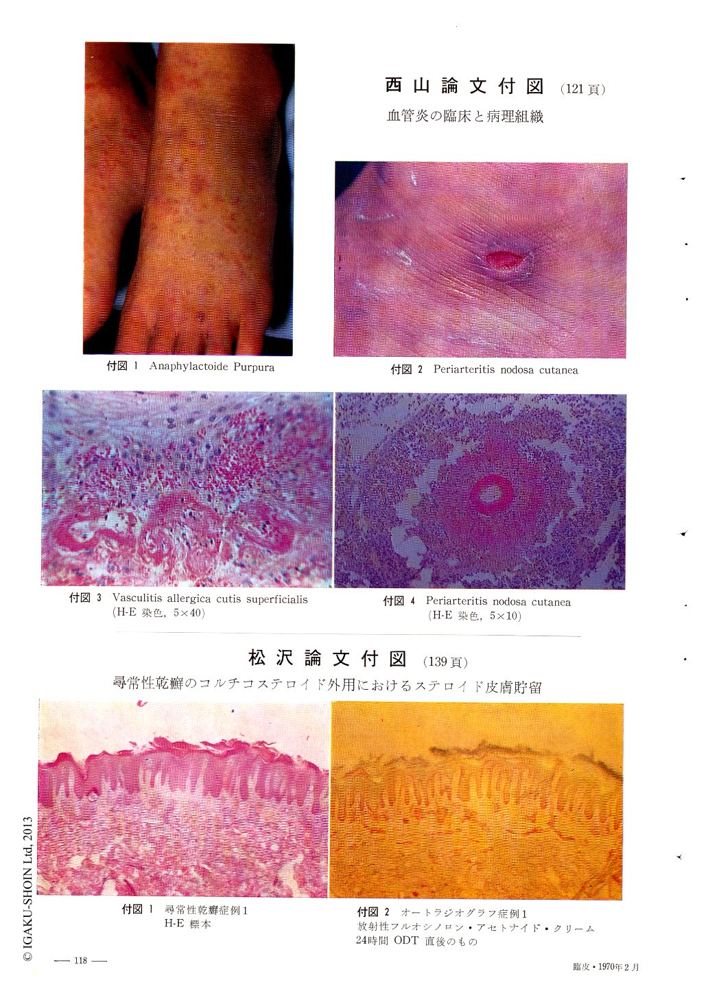血管炎の臨床と病理組織 (臨床皮膚科 24巻2号) | 医書.jp