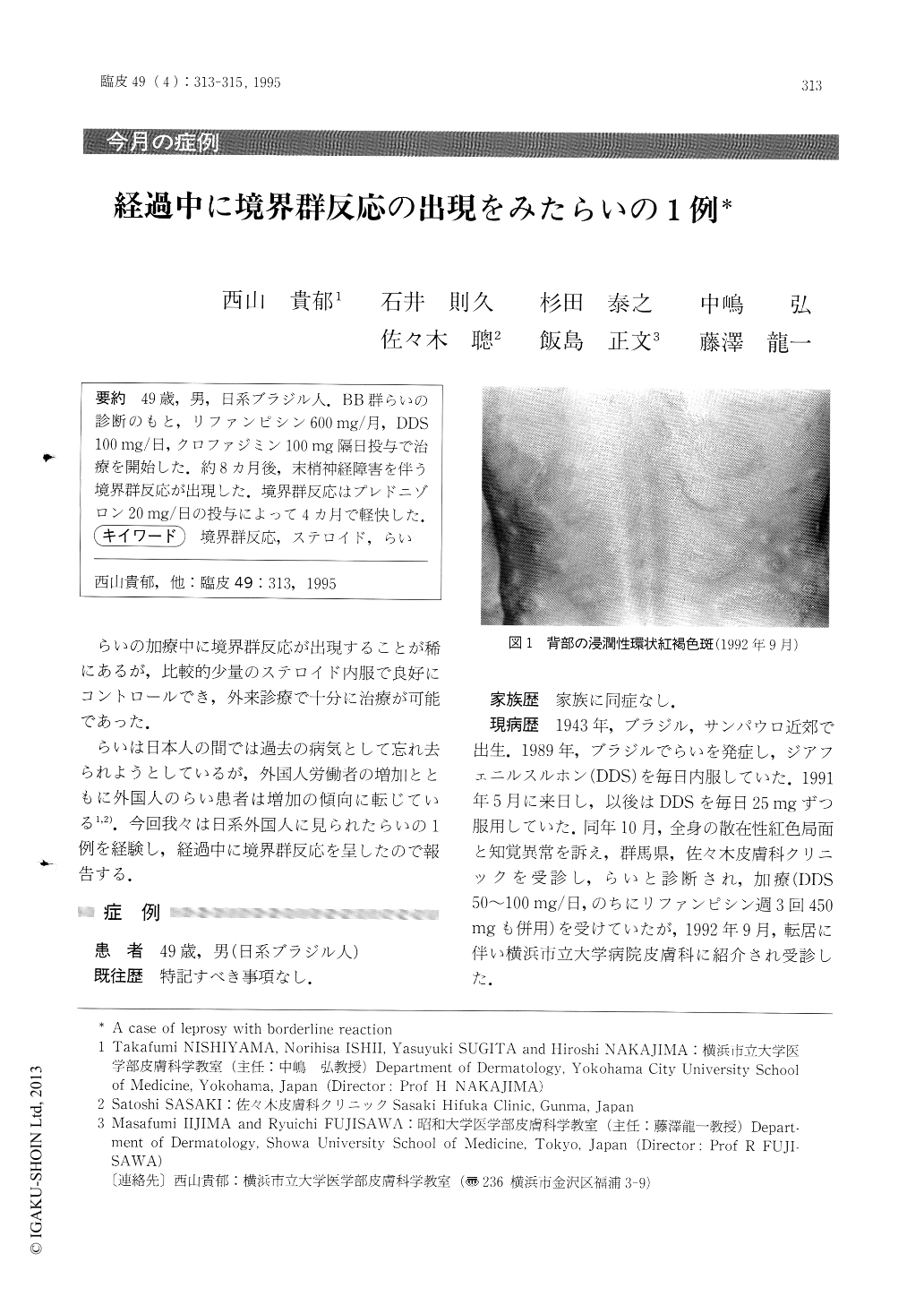 経過中に境界群反応の出現をみたらいの1例 臨床皮膚科 49巻4号 医書 Jp