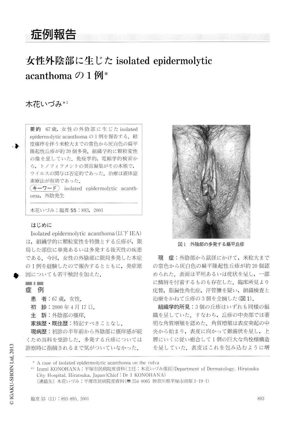 女性外陰部に生じたisolated Epidermolytic Acanthomaの1例 臨床皮膚科 55巻11号 医書 Jp