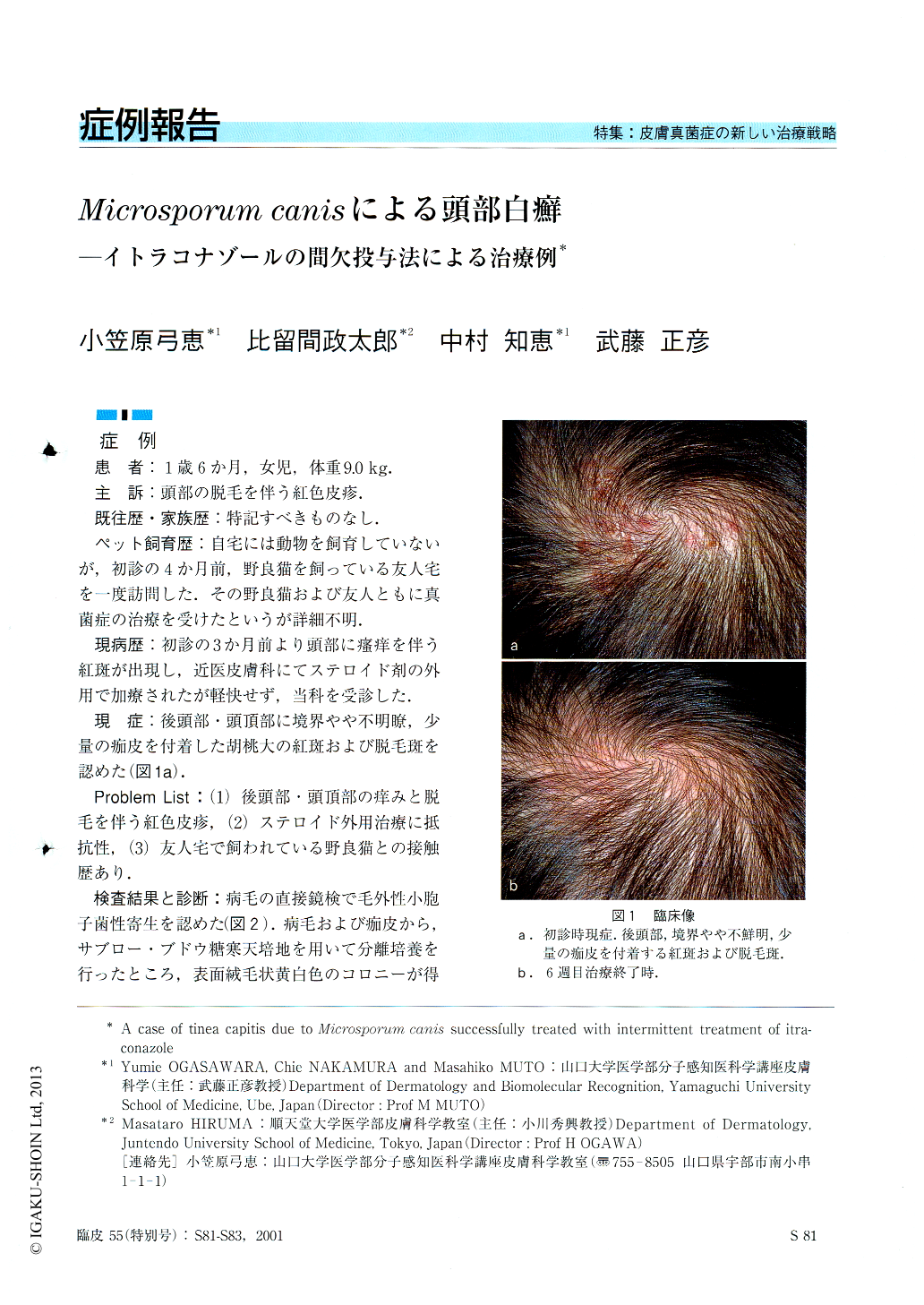 Microsporum Canisによる頭部白癬 イトラコナゾールの間欠投与法による治療例 臨床皮膚科 55巻14号 医書 Jp