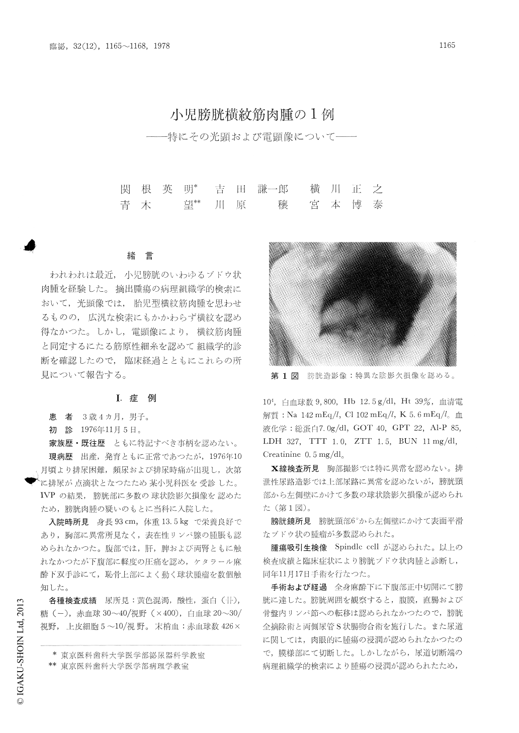 小児膀胱横紋筋肉腫の1例 特にその光顕および電顕像について 臨床泌尿器科 32巻12号 医書 Jp