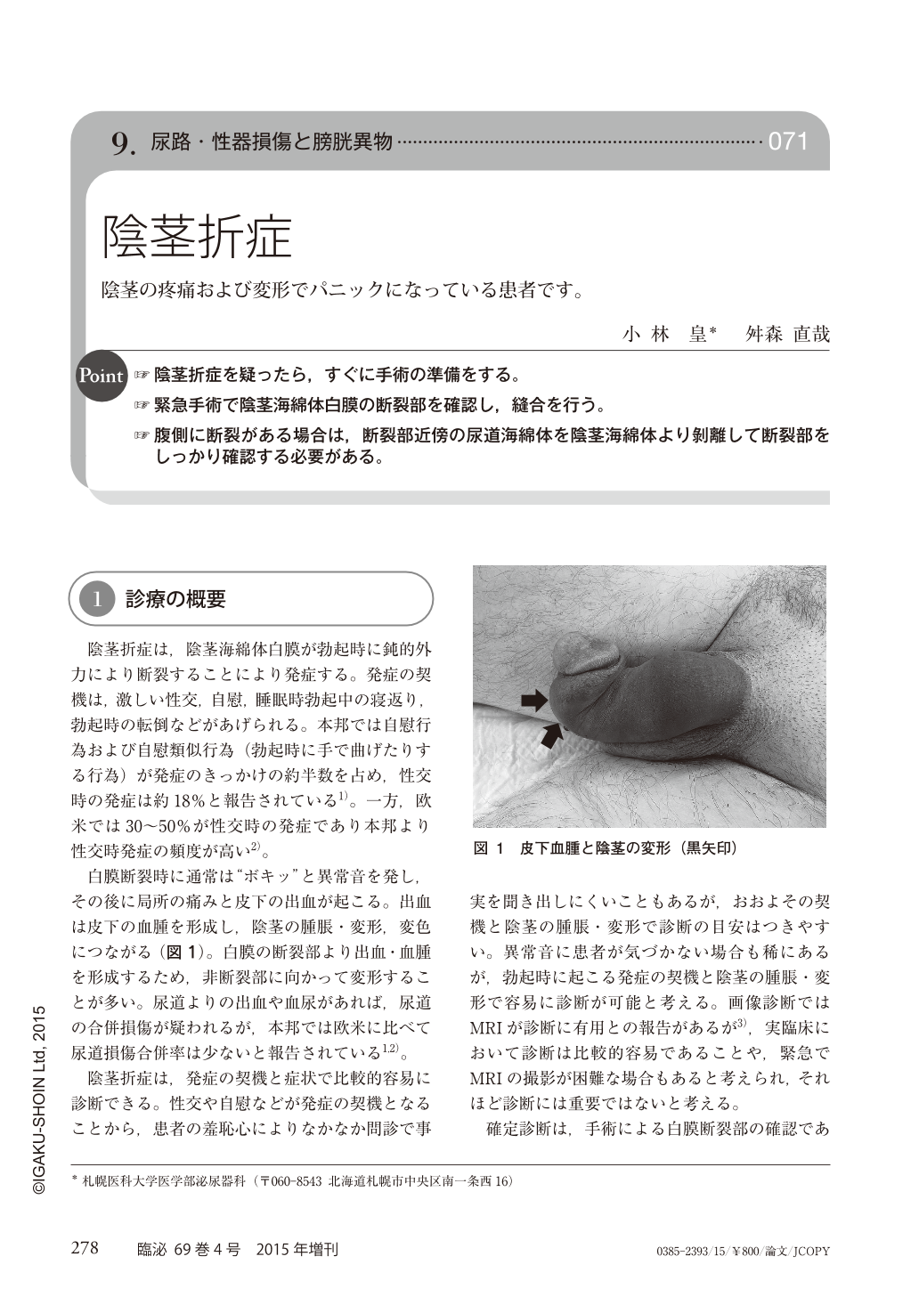 71 陰茎折症 陰茎の疼痛および変形でパニックになっている患者です 臨床泌尿器科 69巻4号 医書 Jp