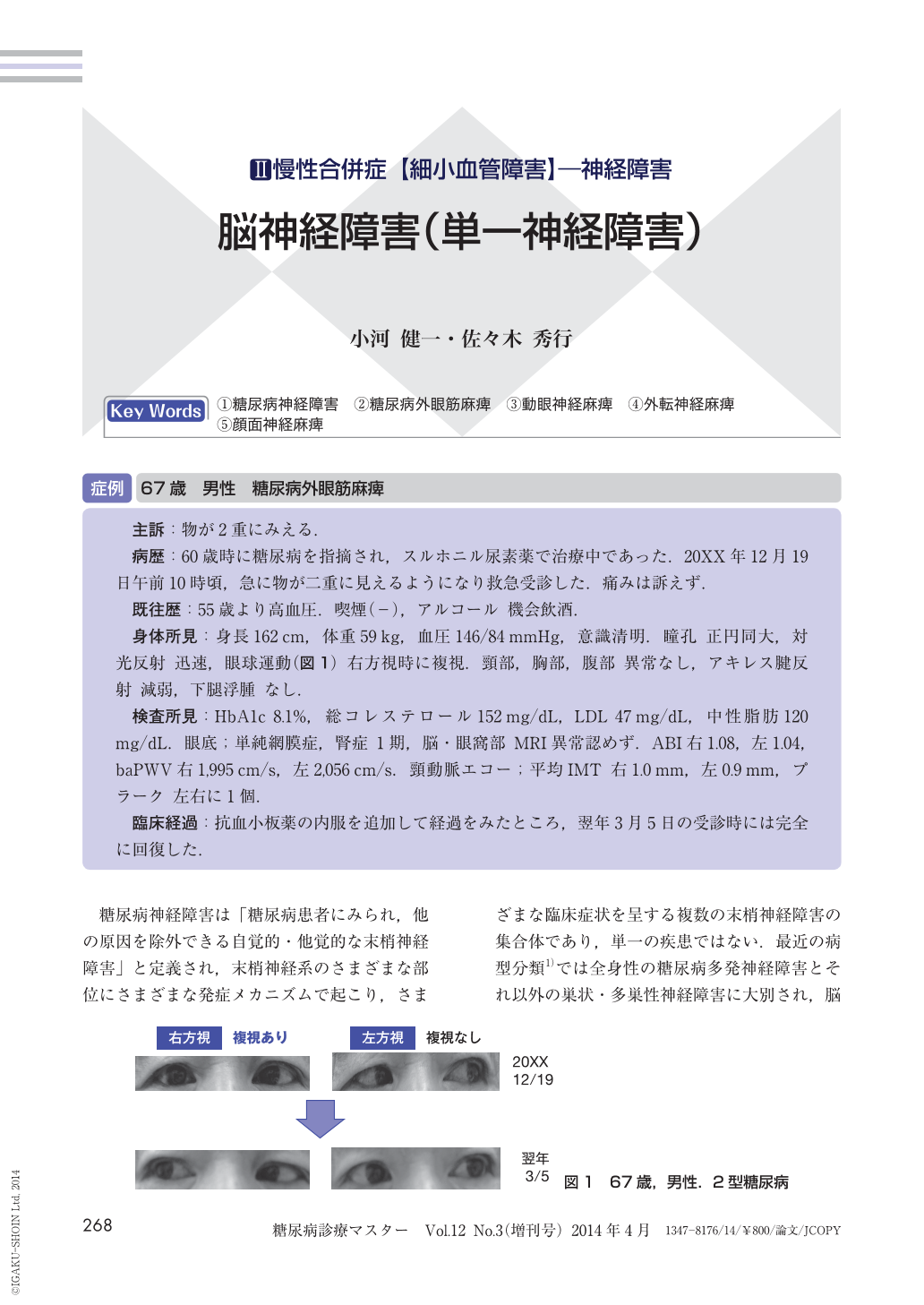 脳神経障害 単一神経障害 糖尿病診療マスター 12巻3号 医書 Jp