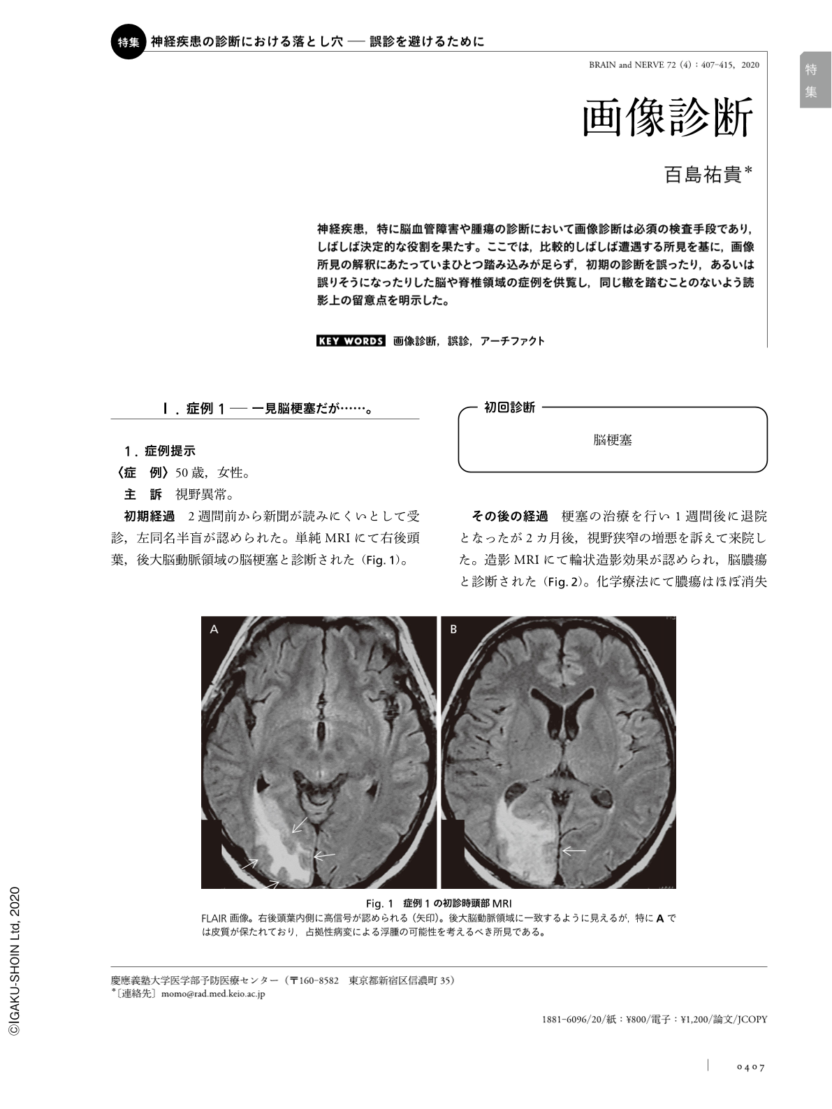 画像診断 (BRAIN and NERVE 72巻4号) | 医書.jp